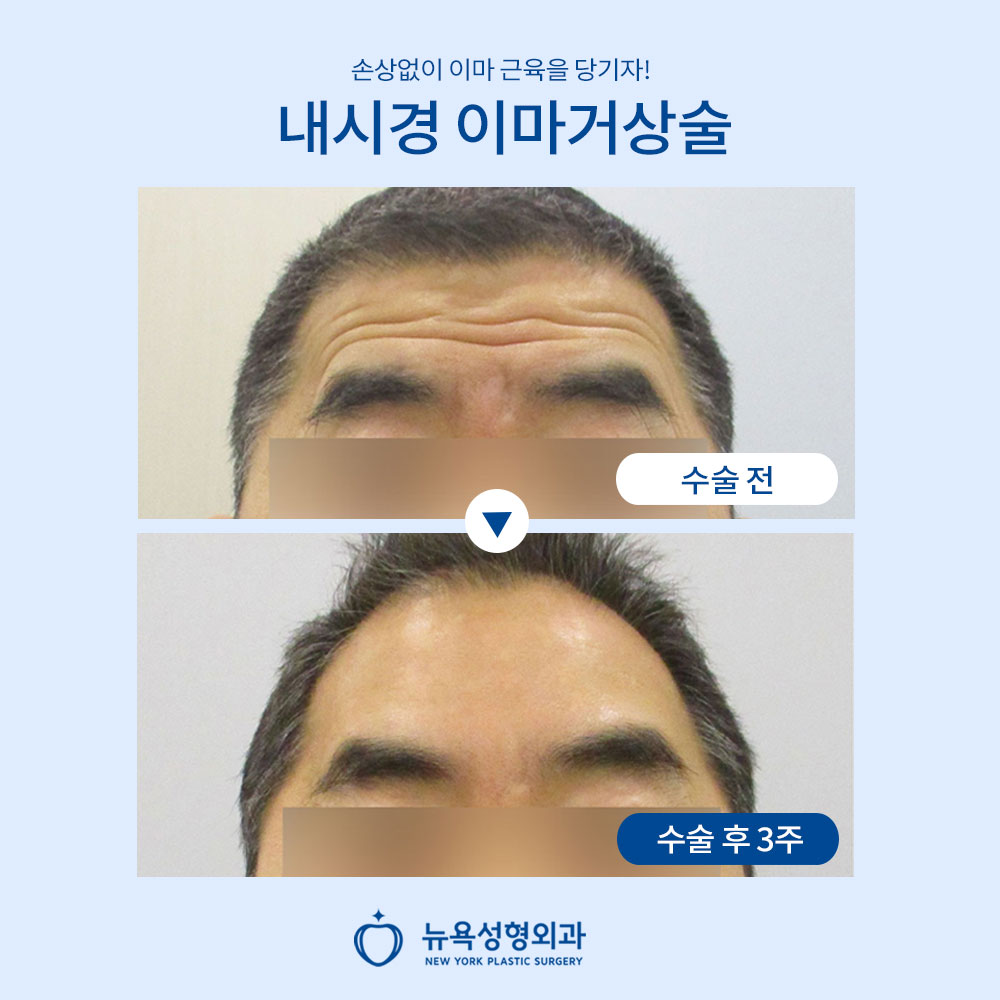 뉴욕성형외과