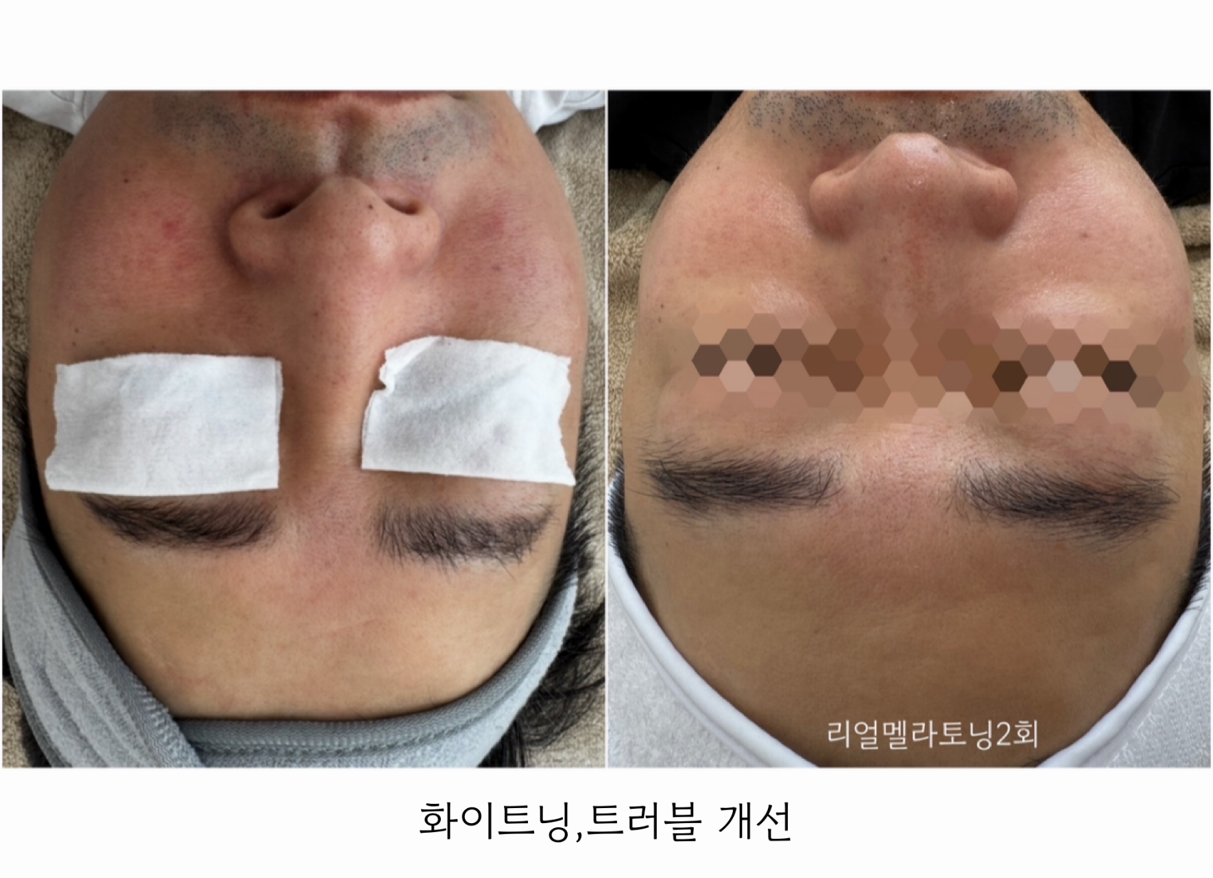 더모어 대표 이미지