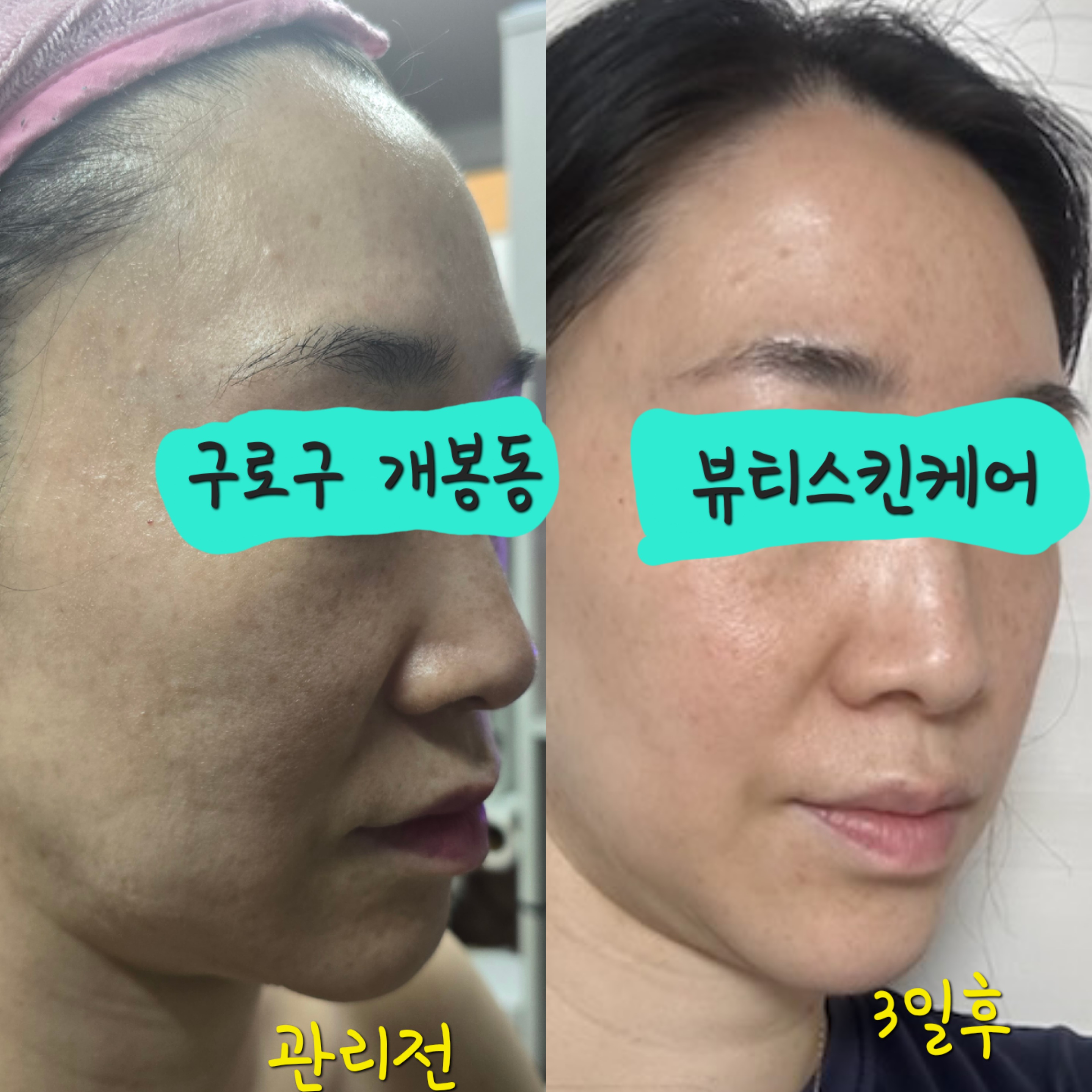 뷰티스킨케어 대표 이미지