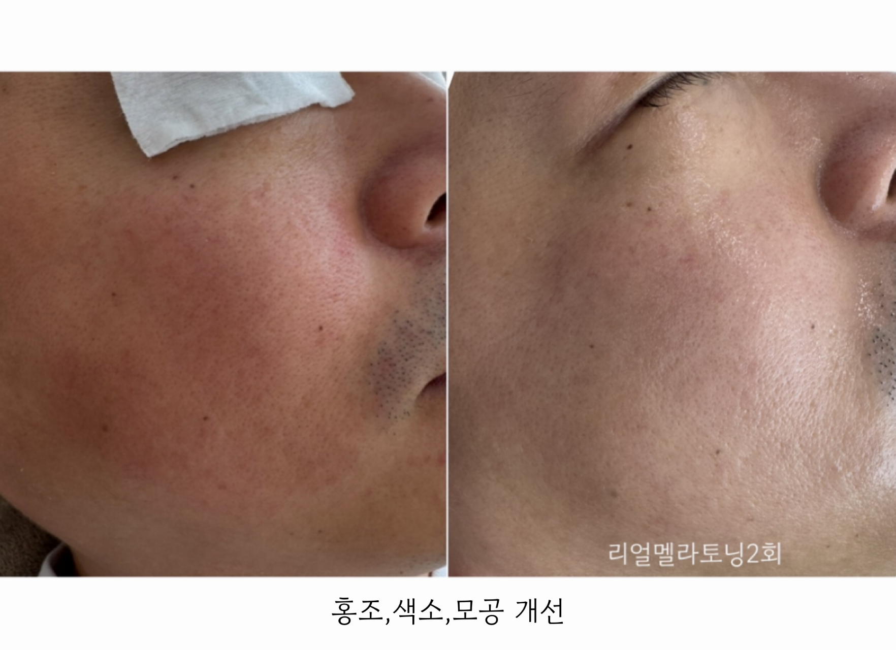 더모어 대표 이미지