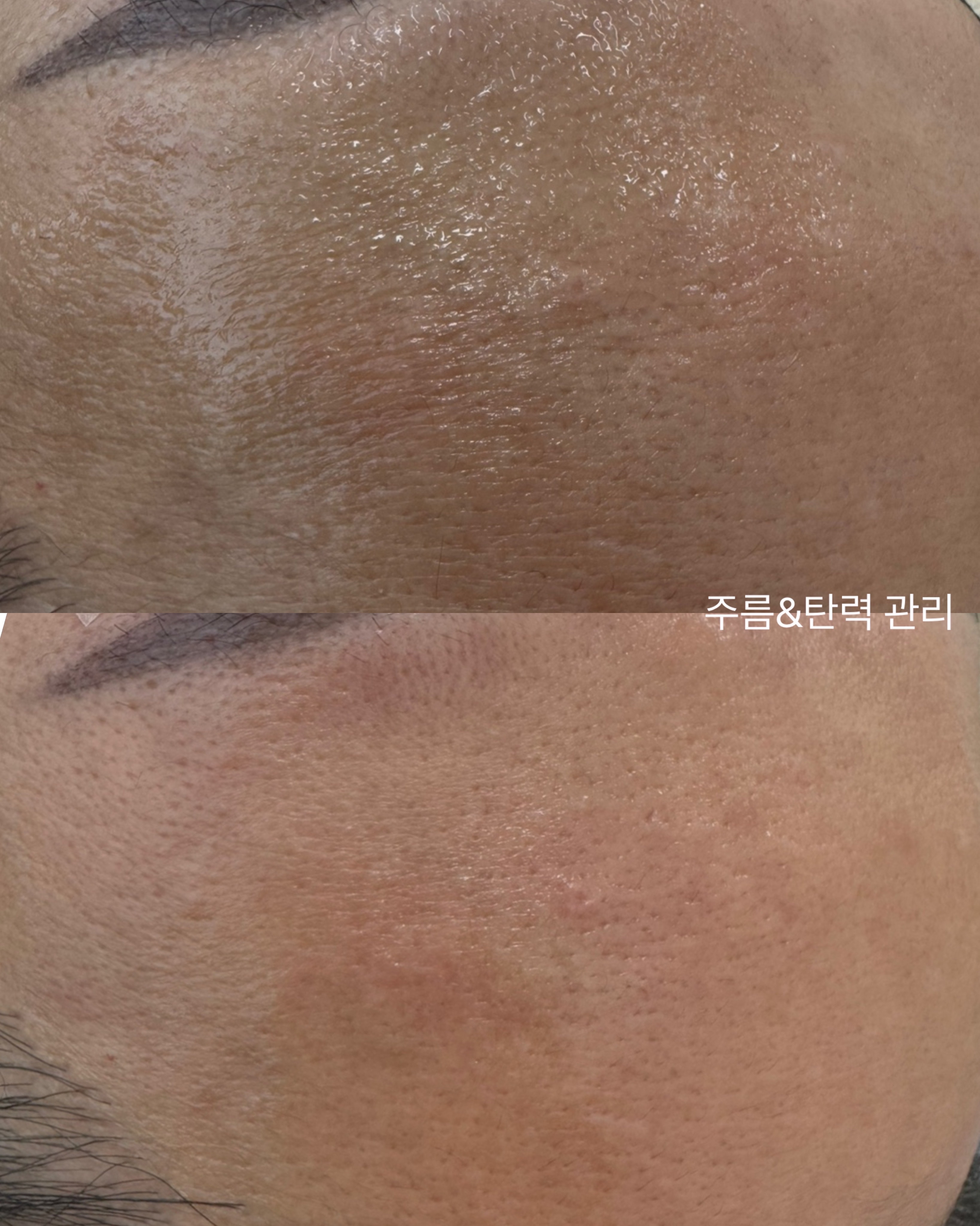 더모어 대표 이미지