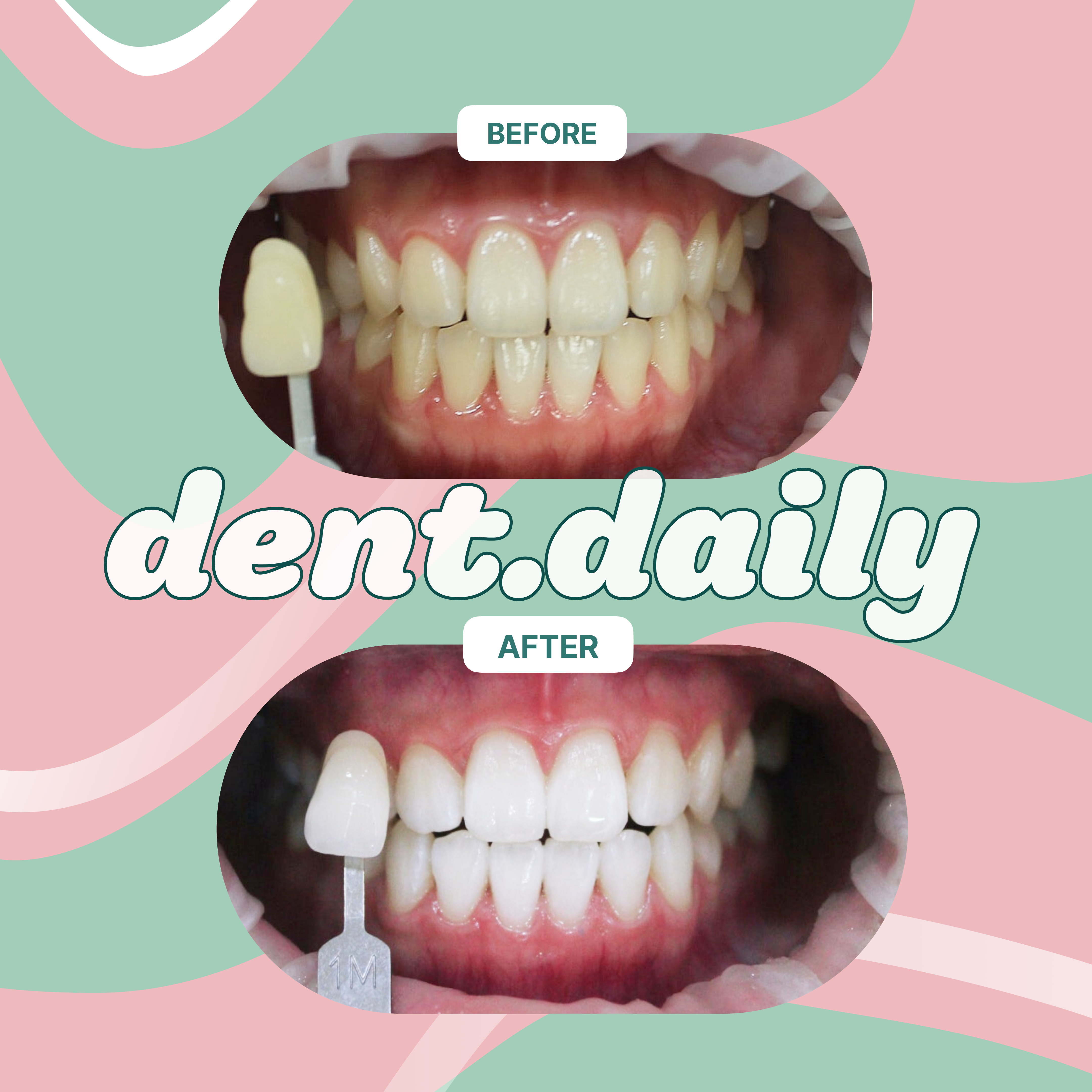 종로30분치과의원 대표 이미지