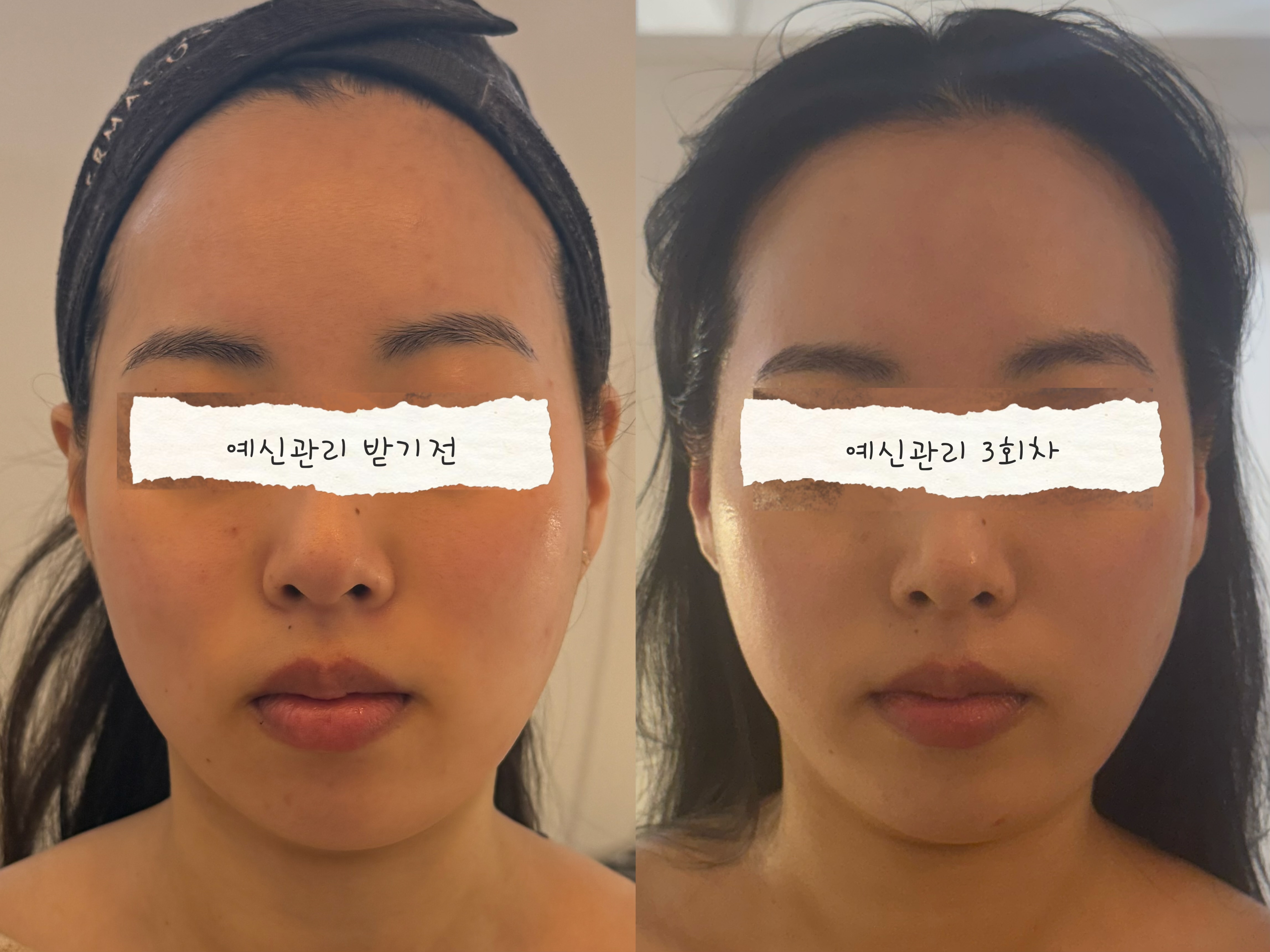 에어리 스킨룸 대표 이미지
