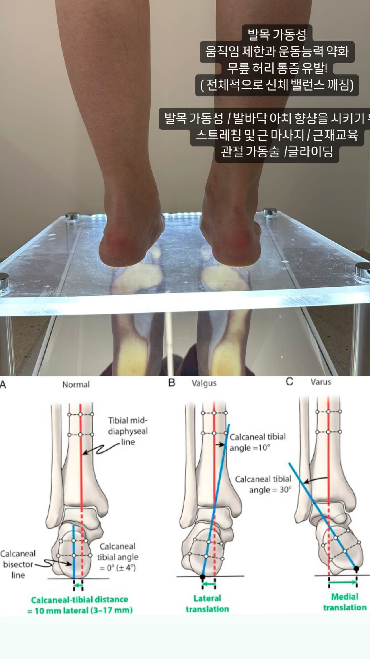 좋은몸 바른체형 교정원