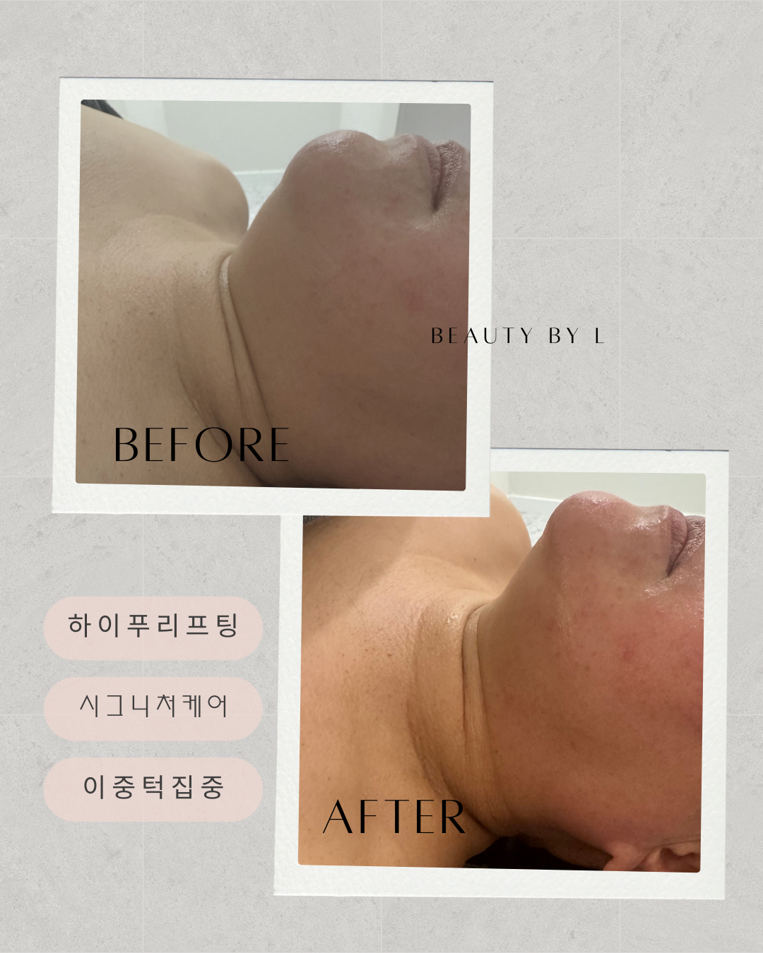 뷰티바이엘