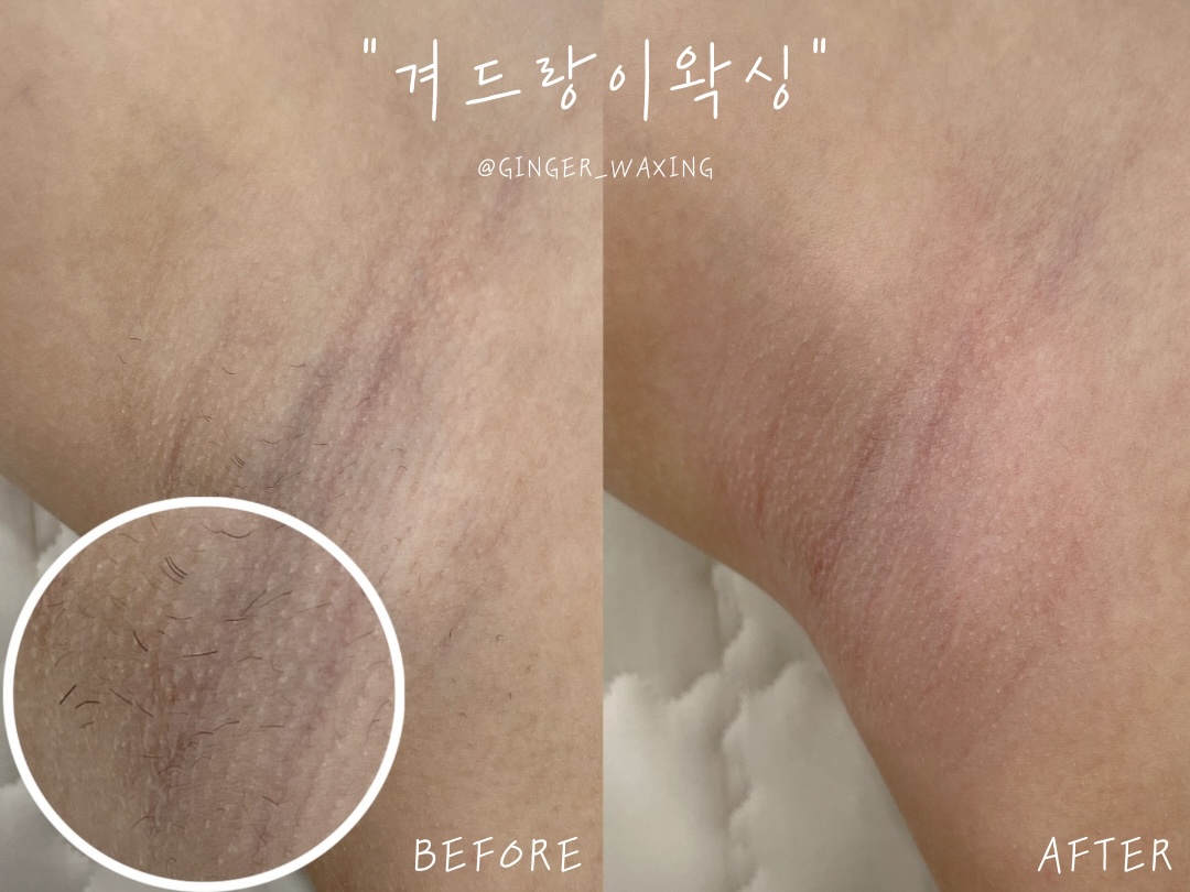 진저뷰티&왁싱 대표 이미지