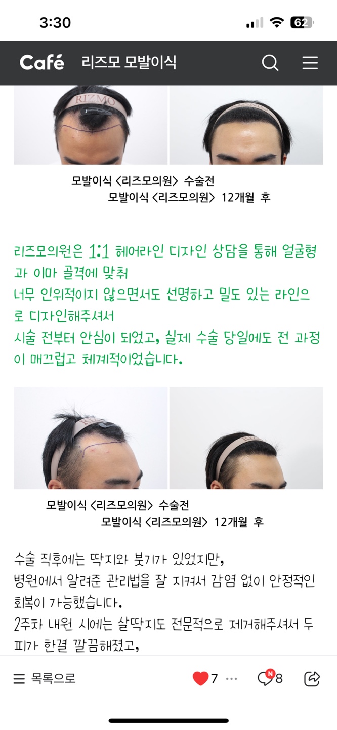 리즈모의원 대전 대표 이미지