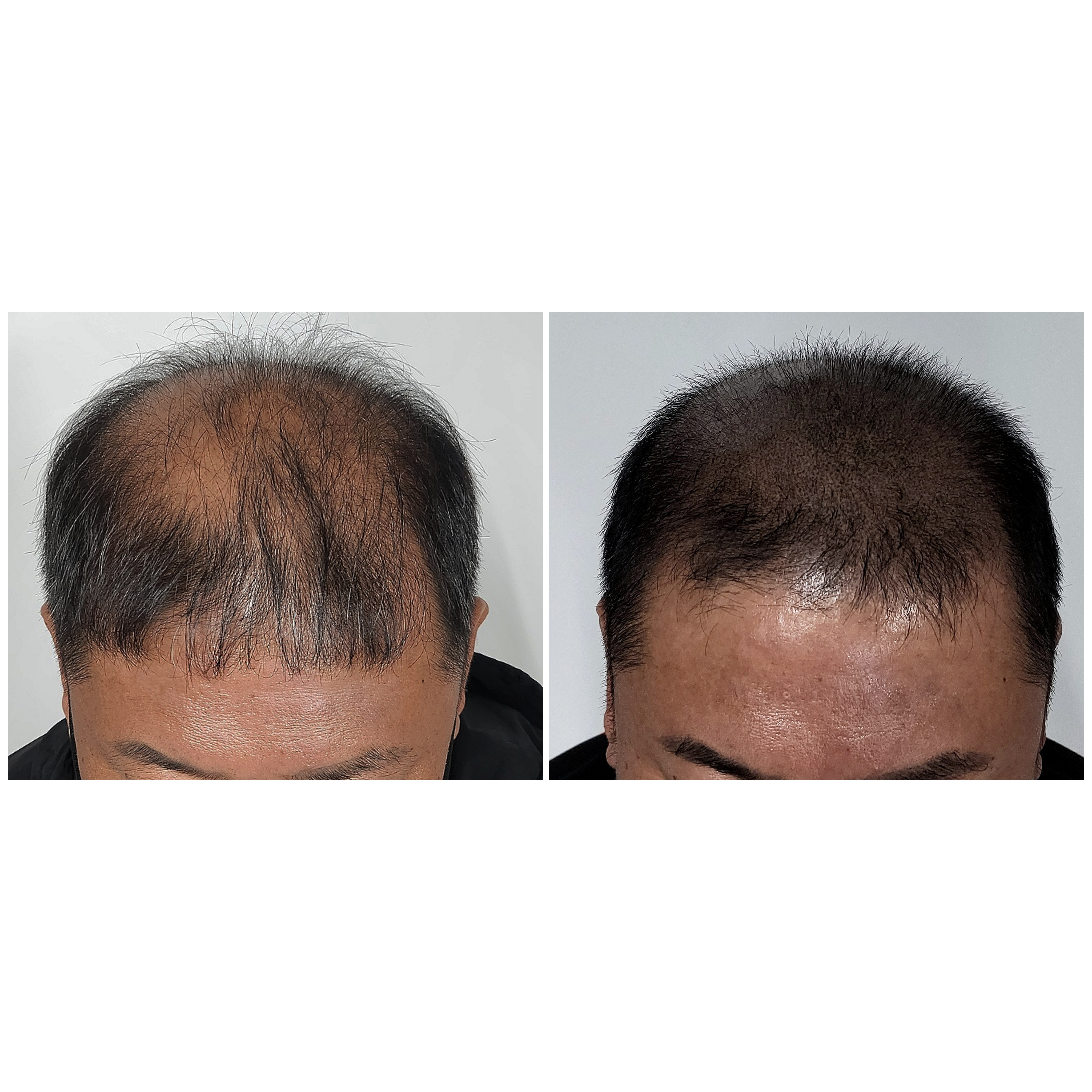 디블랙아카데미 대표 이미지