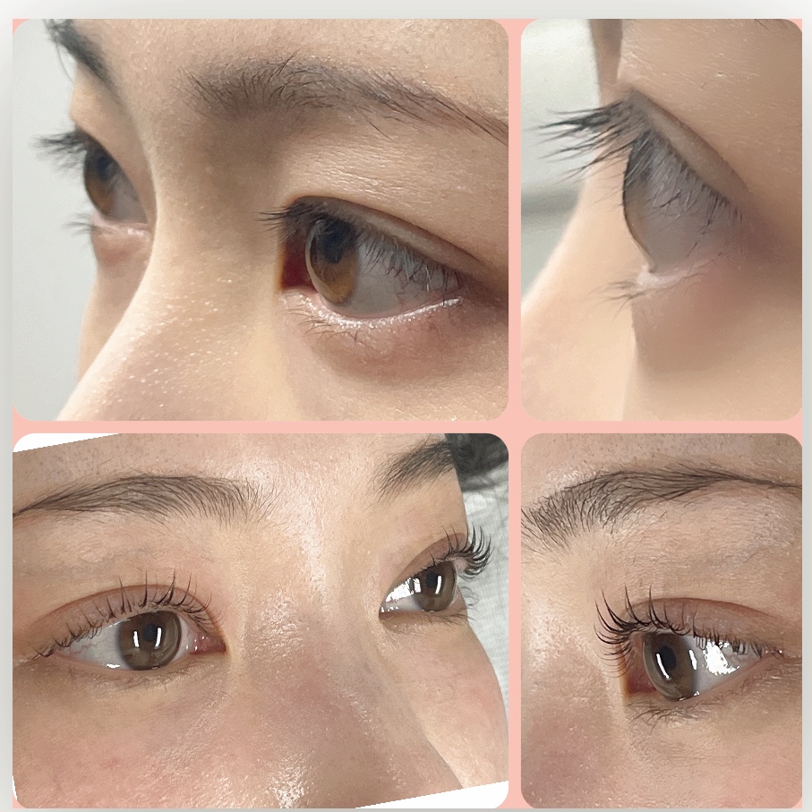 로로아뷰티 대표 이미지