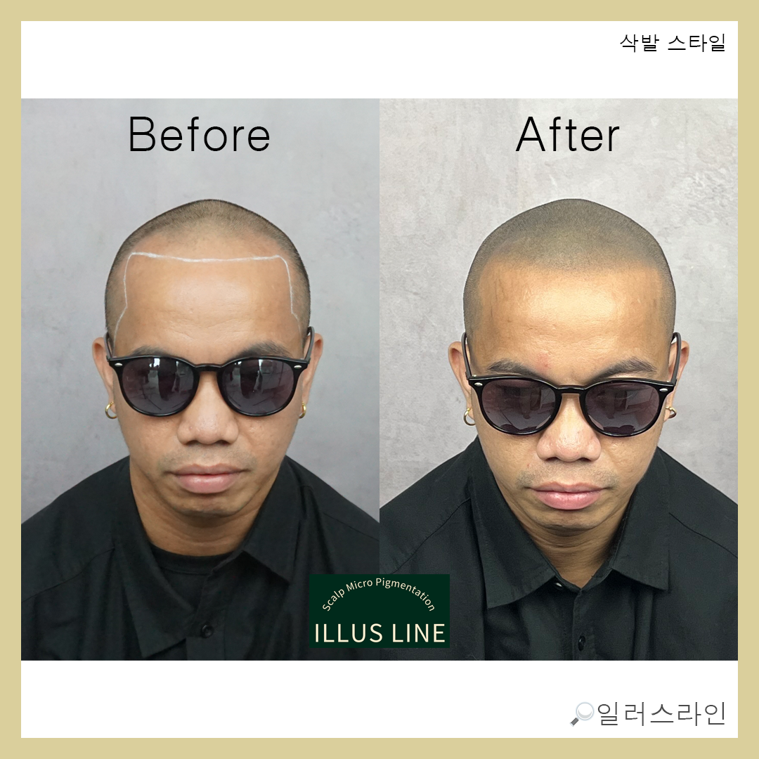 일러스라인 대표 이미지