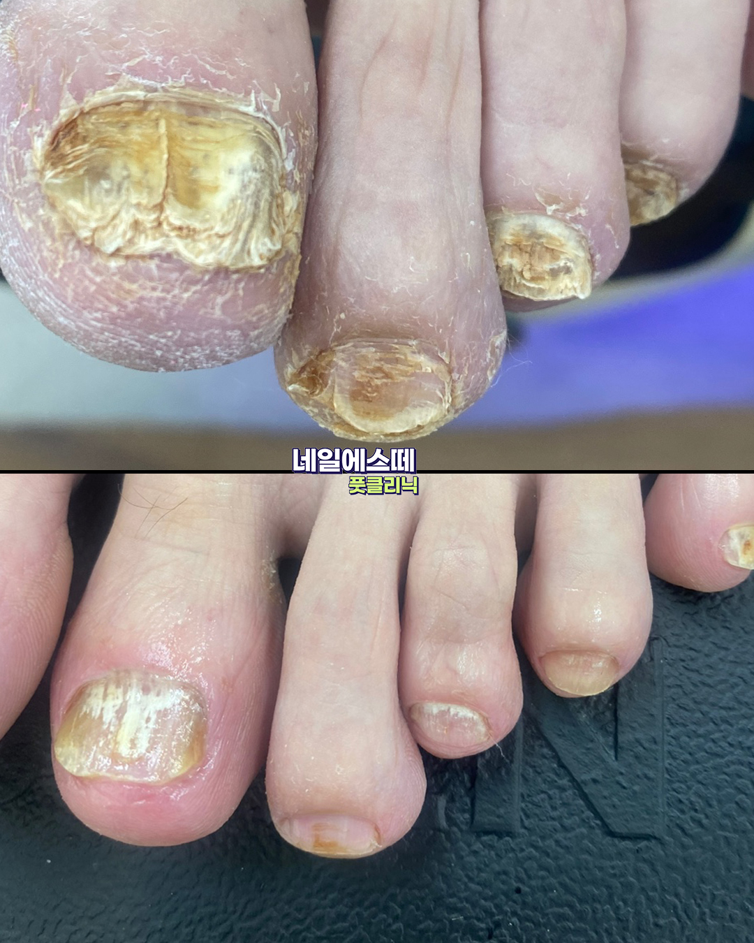 네일에스떼 대표 이미지