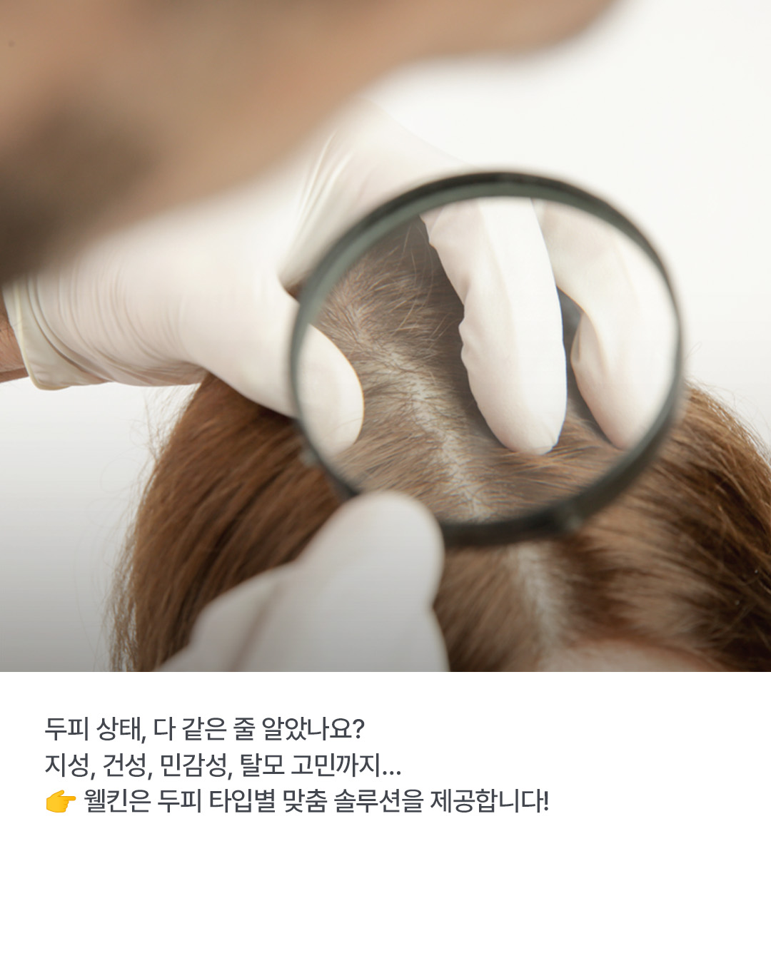 웰킨 두피탈모센터 종로점 대표 이미지