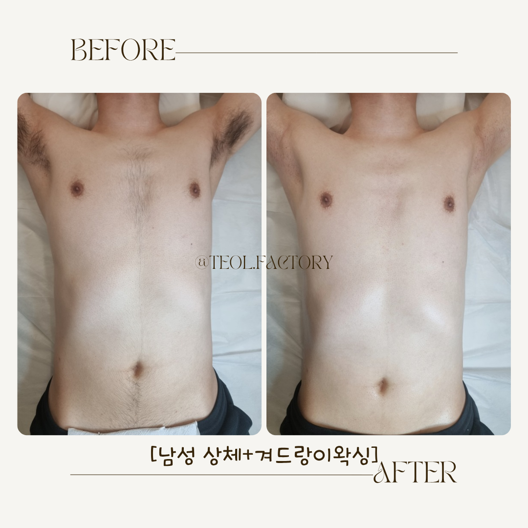 상봉왁싱 털공장 대표 이미지