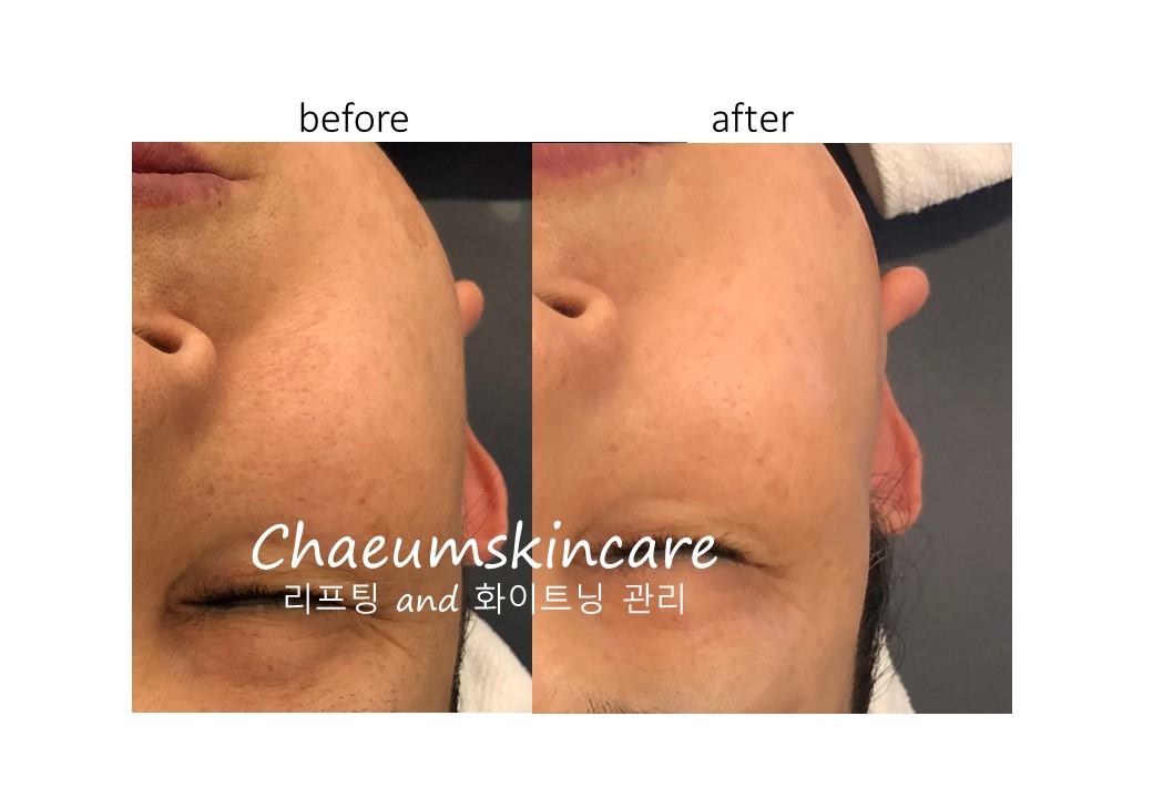 채움피부관리실