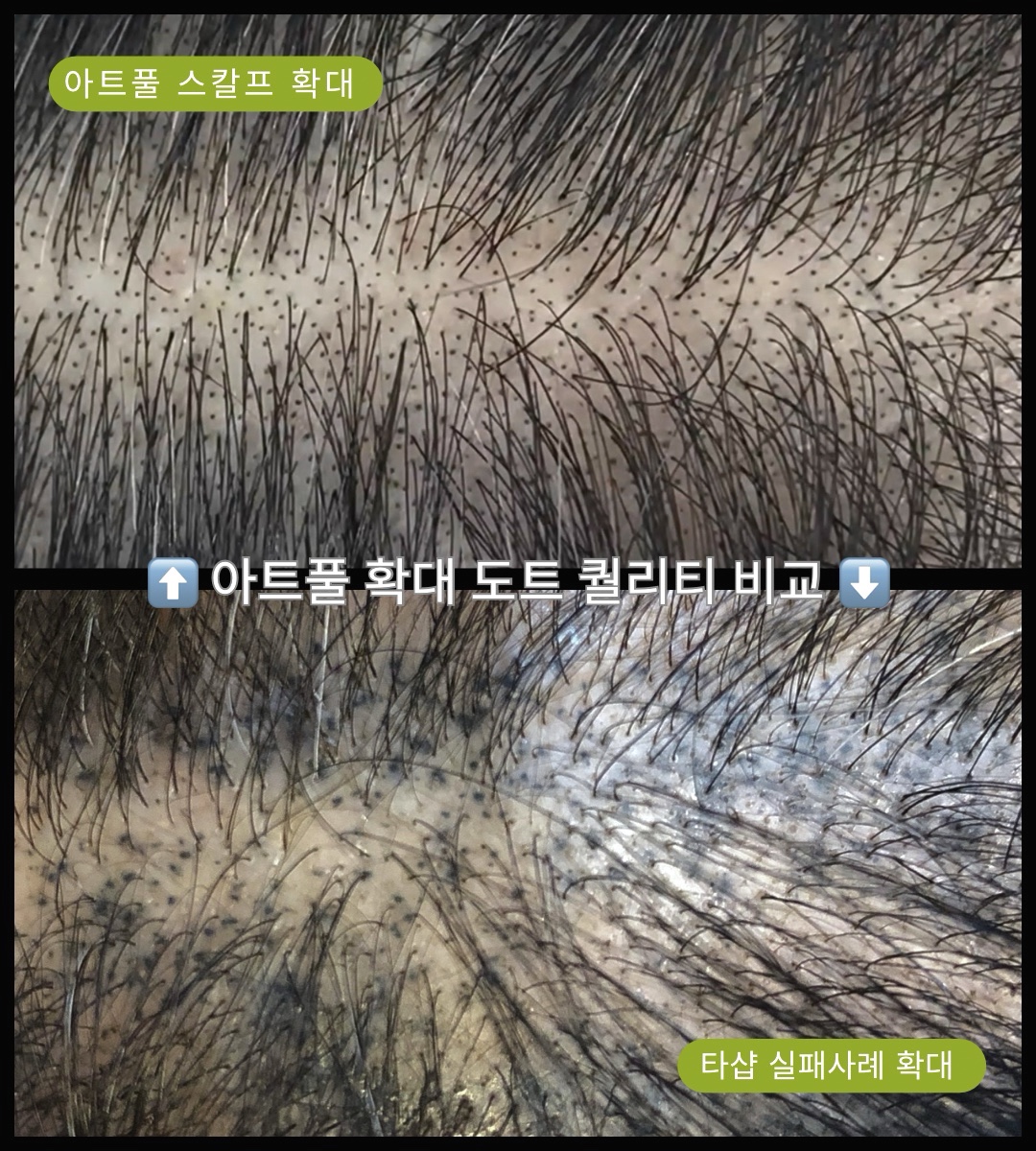 아트풀스칼프 부산 대표 이미지