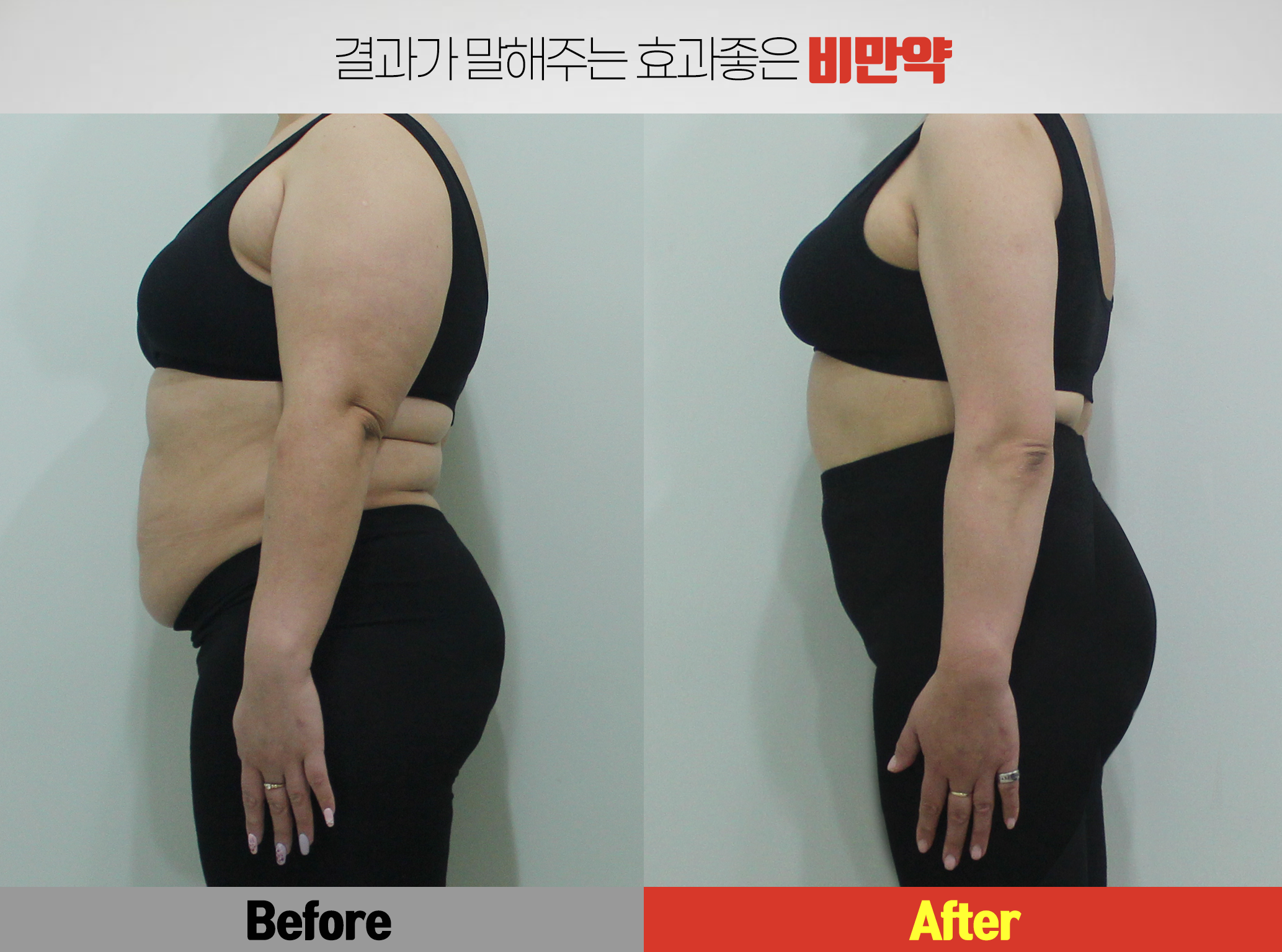 메이드유의원 강남본점 대표 이미지