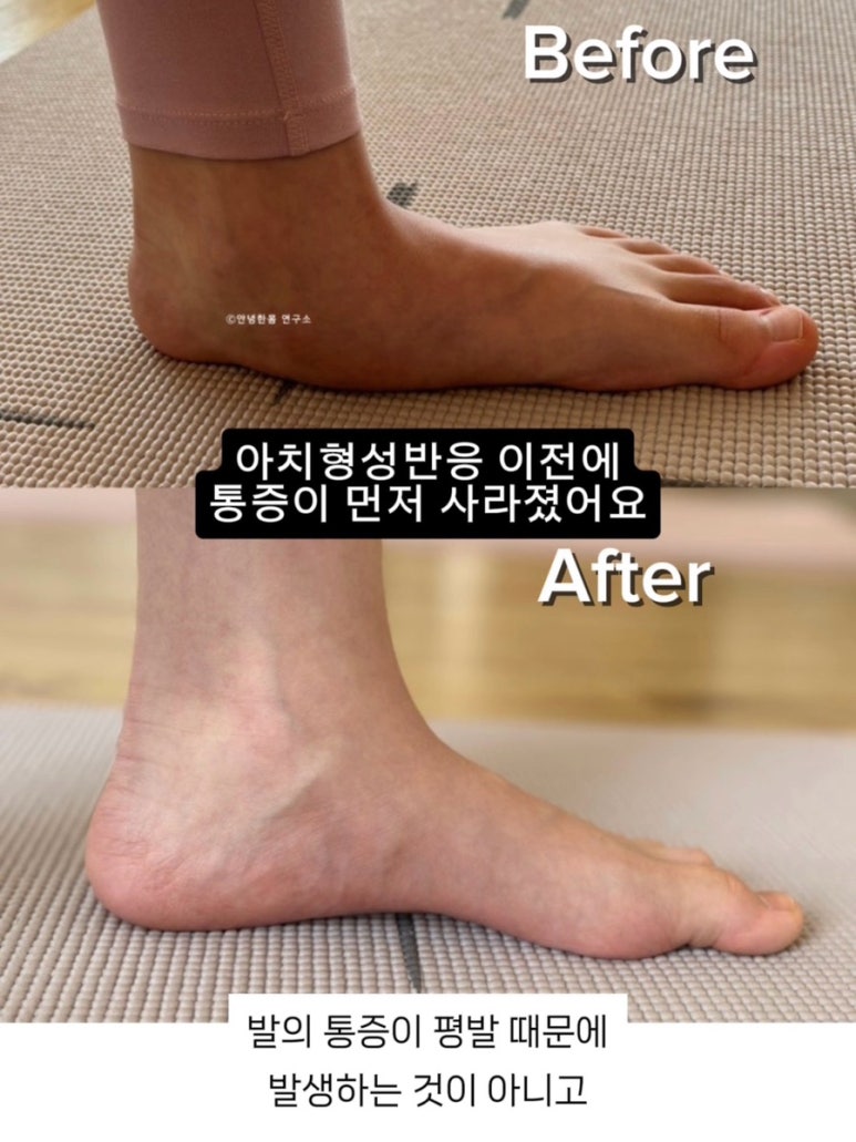 하웰 바른자세운동 대표 이미지