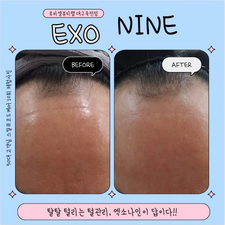 루비셀뷰티랩 대구죽전점 대표 이미지