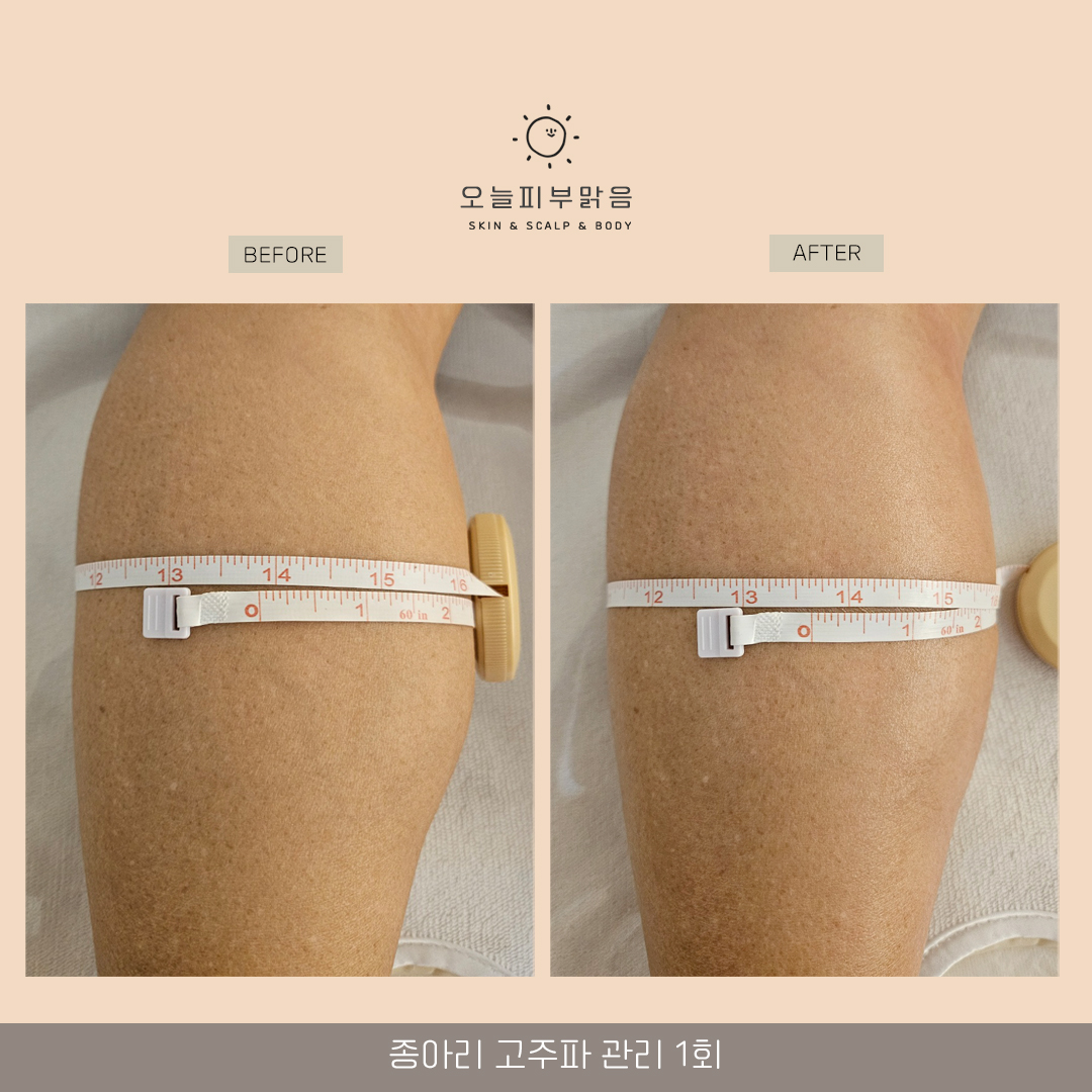 오늘피부맑음 photo 10
