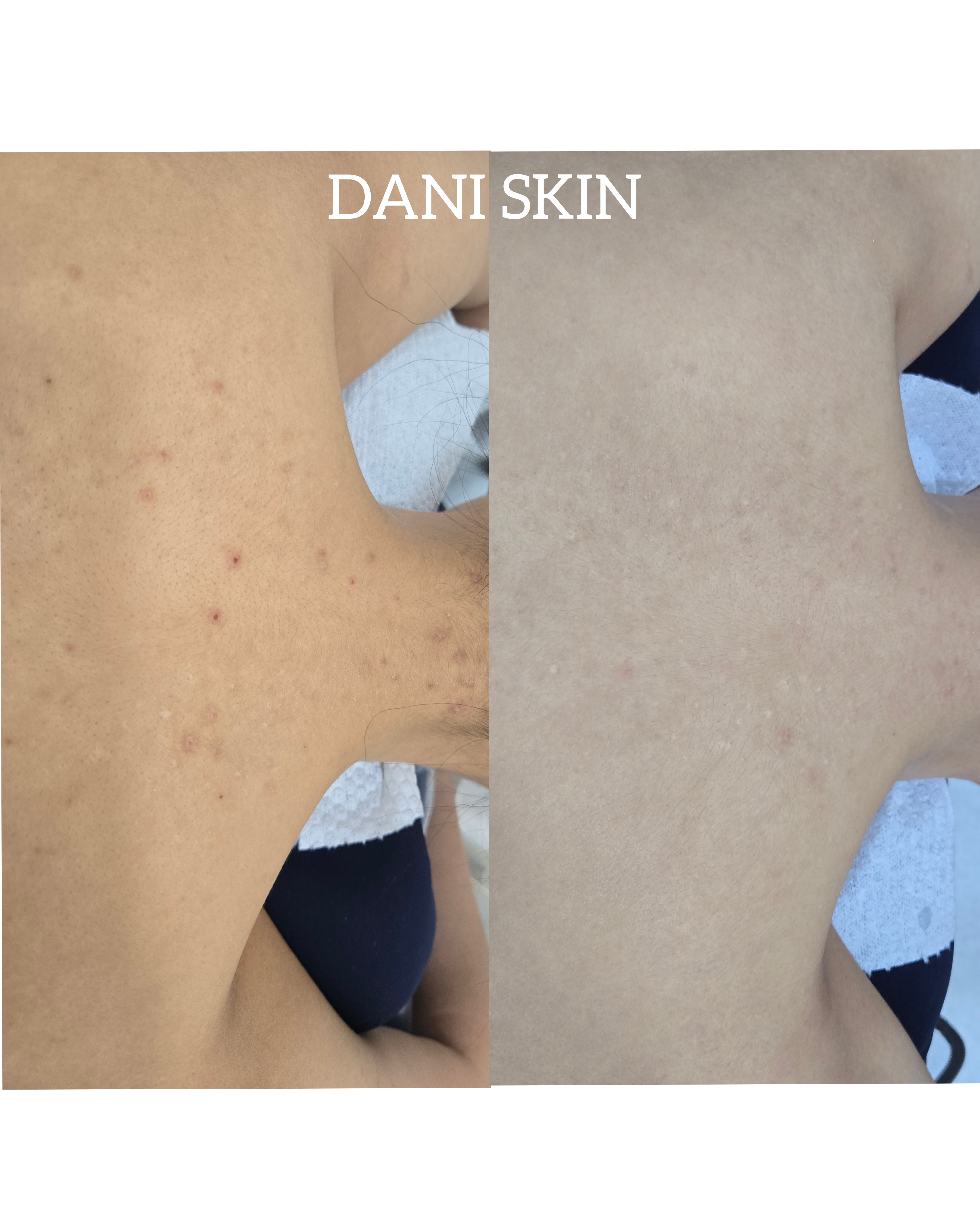 다니스킨 대표 이미지