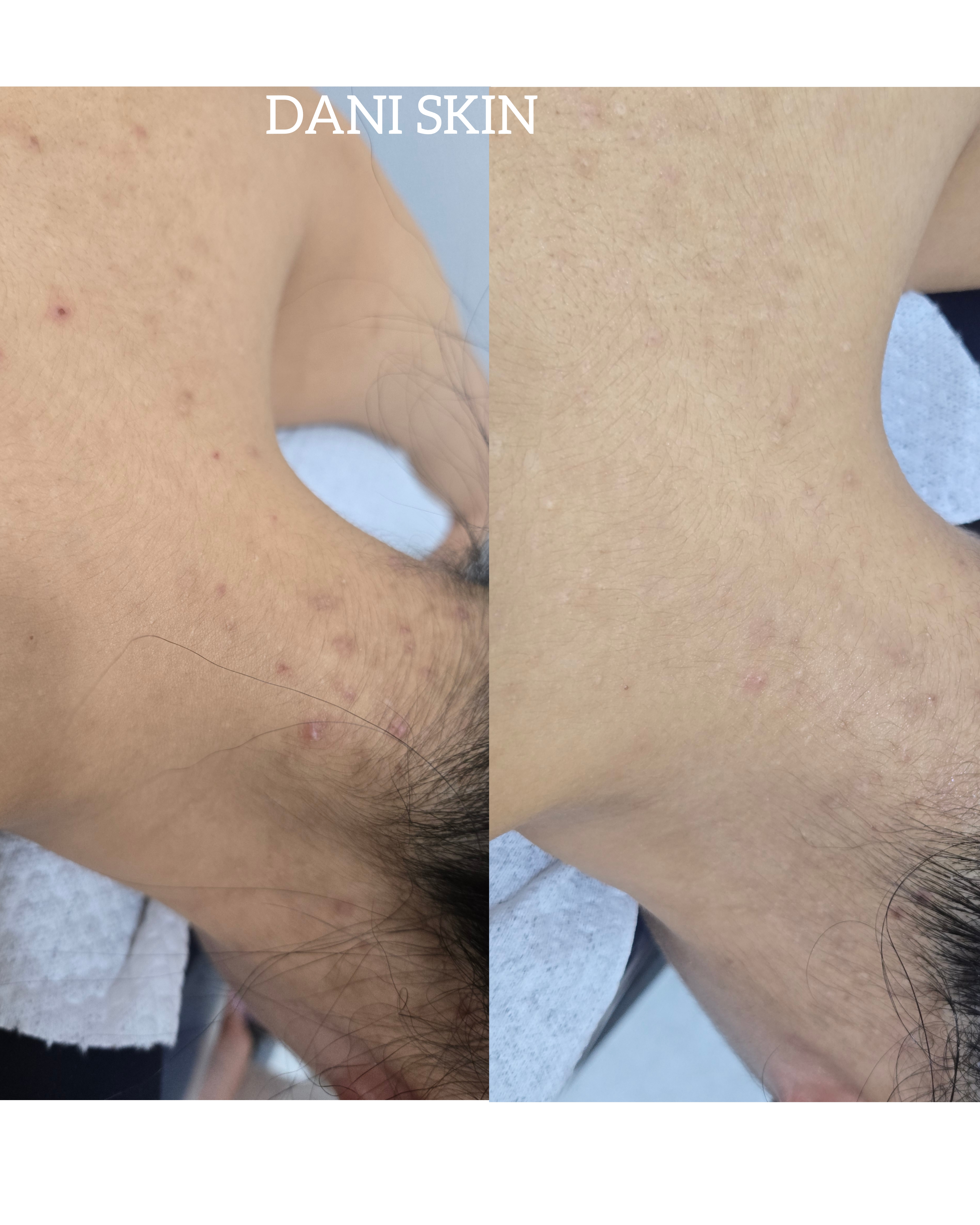 다니스킨 대표 이미지