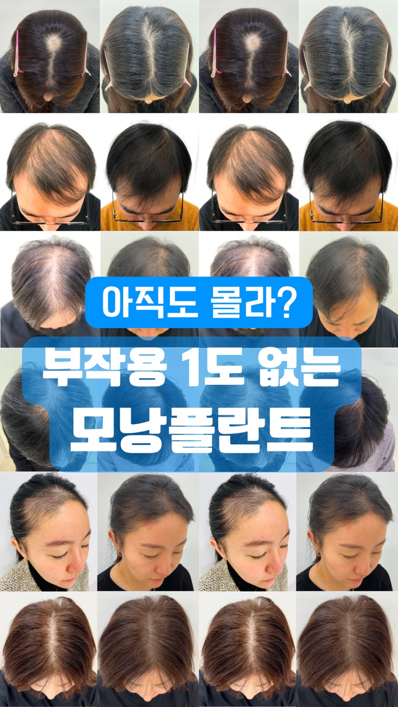 모리셋두피재생센터 당진점 대표 이미지