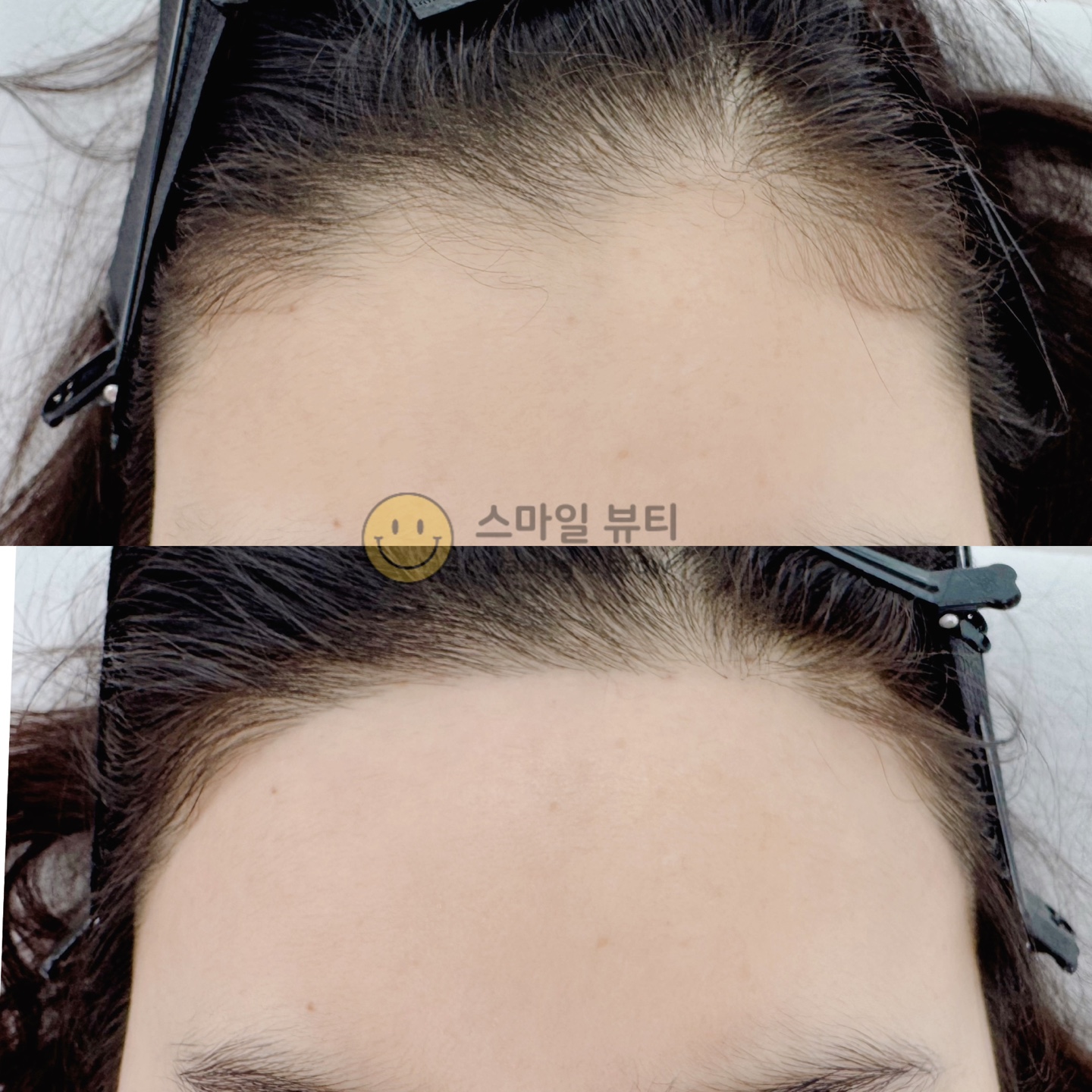 스마일뷰티 대표 이미지