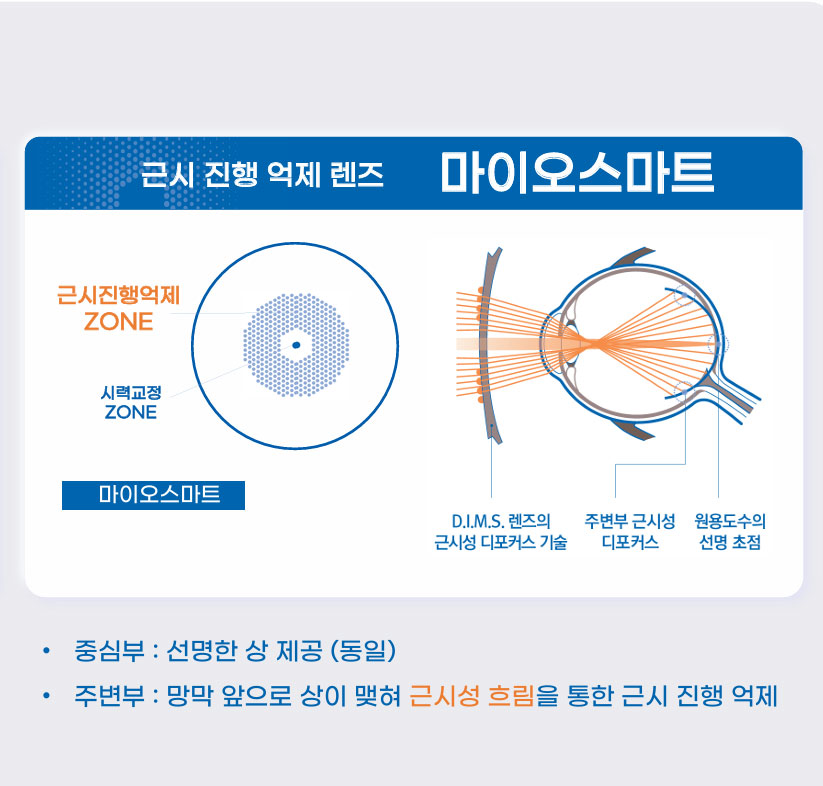 안경오픈하우스