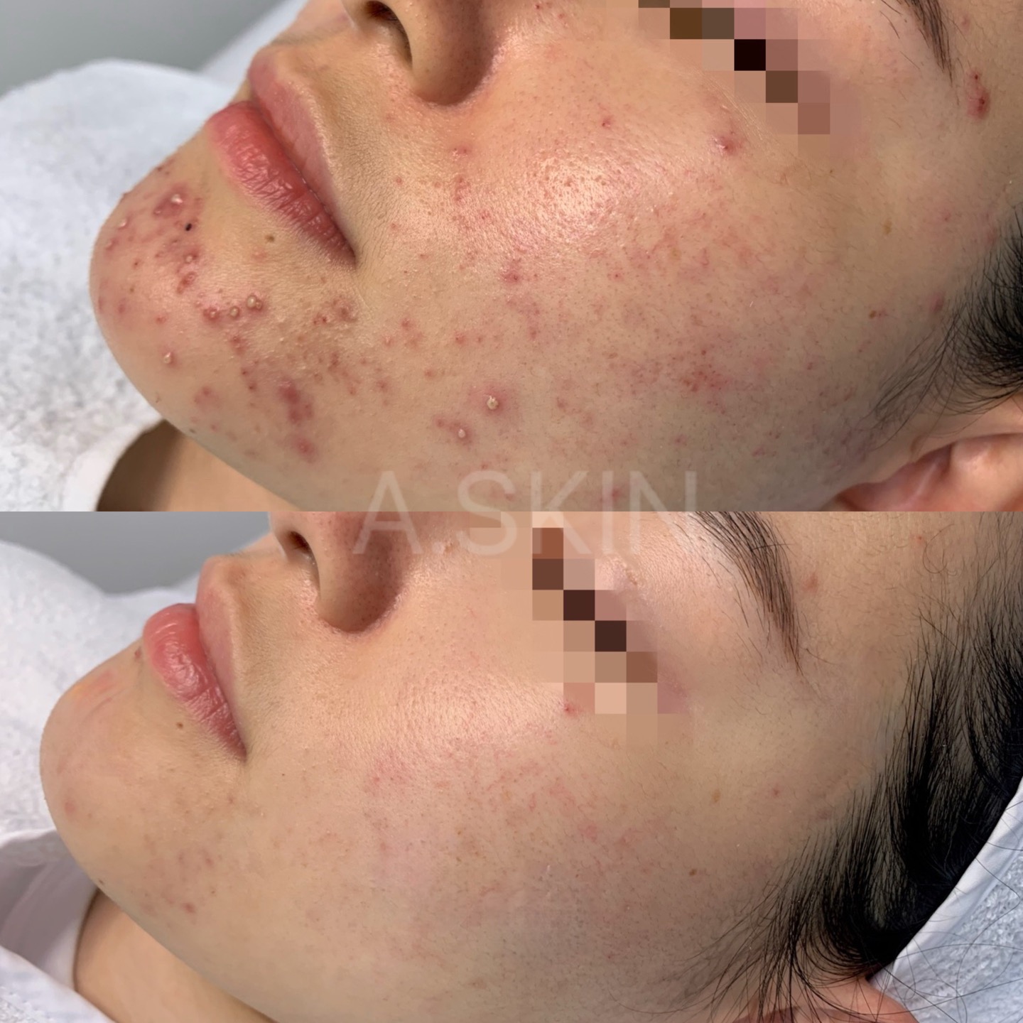 에이스킨 여의도점 대표 이미지