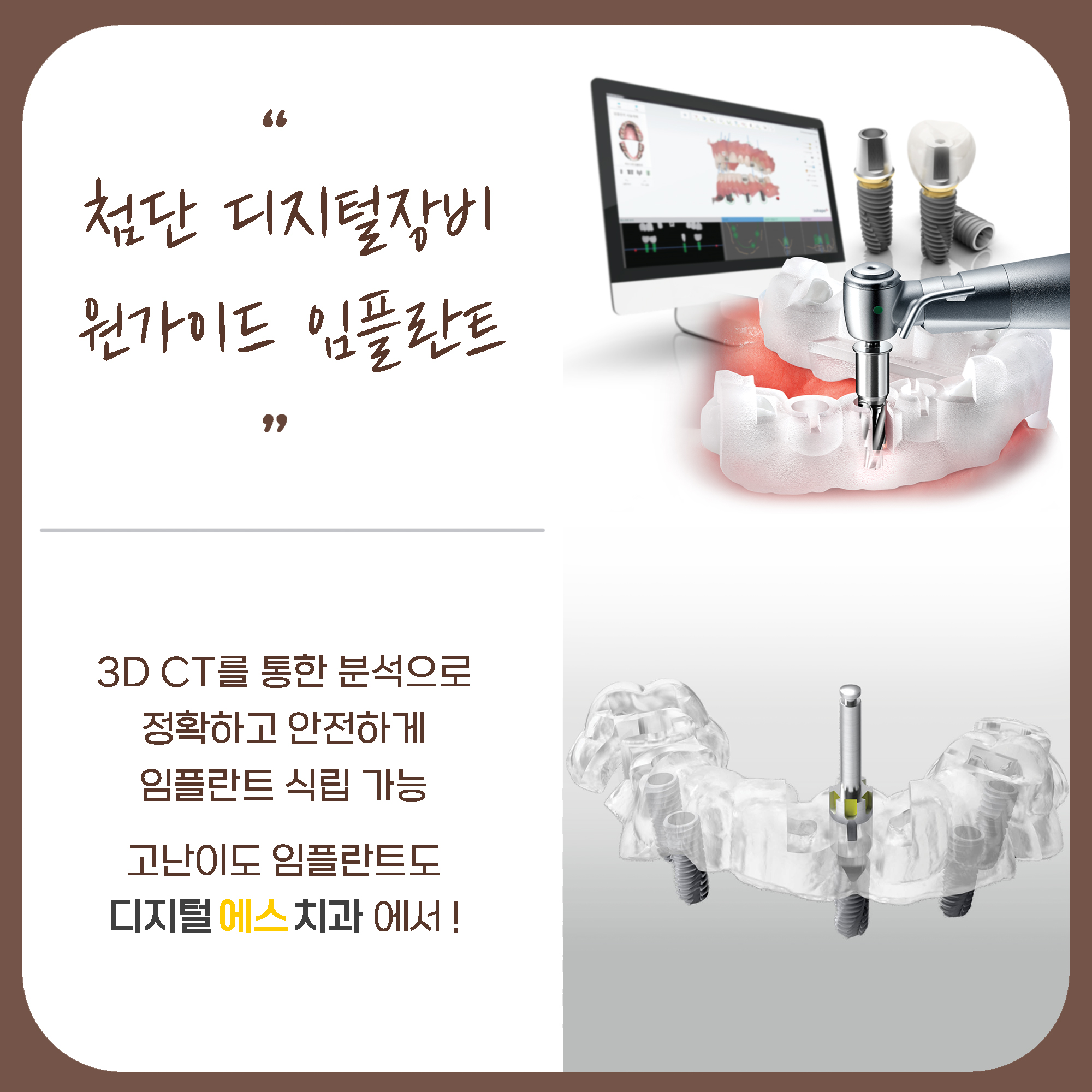 디지털에스치과의원