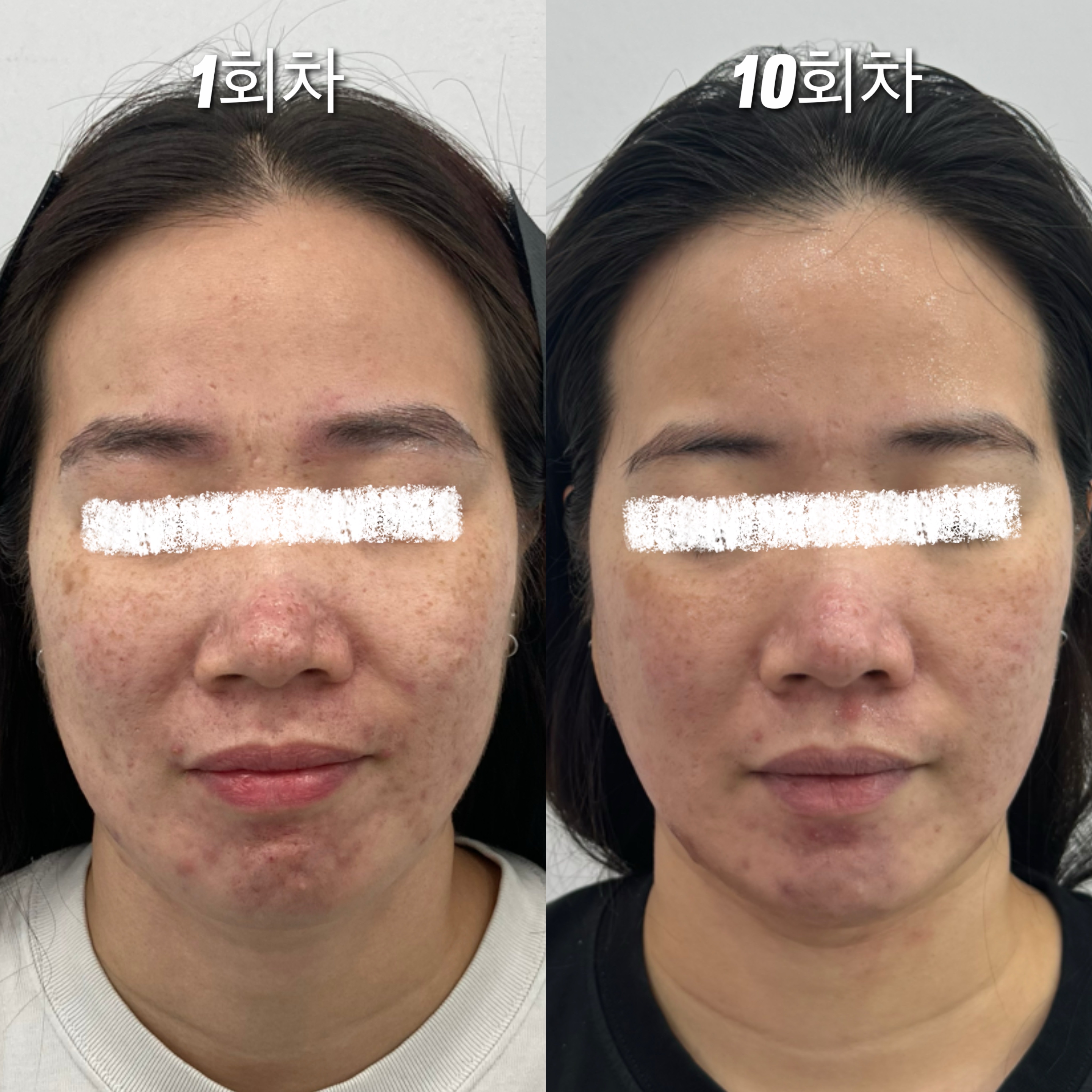 옥정 네일 피그 속눈썹