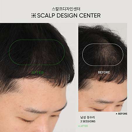 스칼프디자인센터 울산