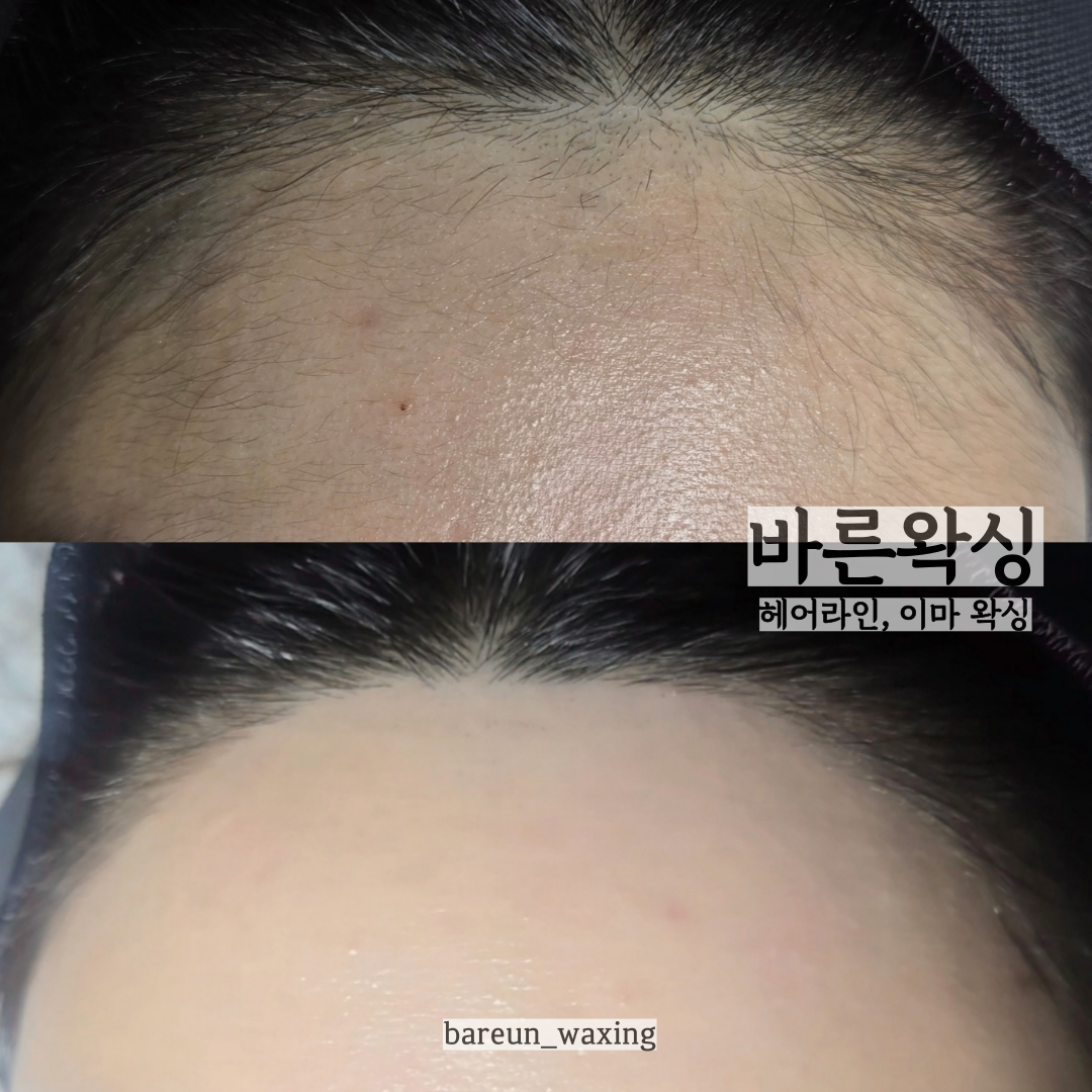 바른왁싱 영등포점 대표 이미지