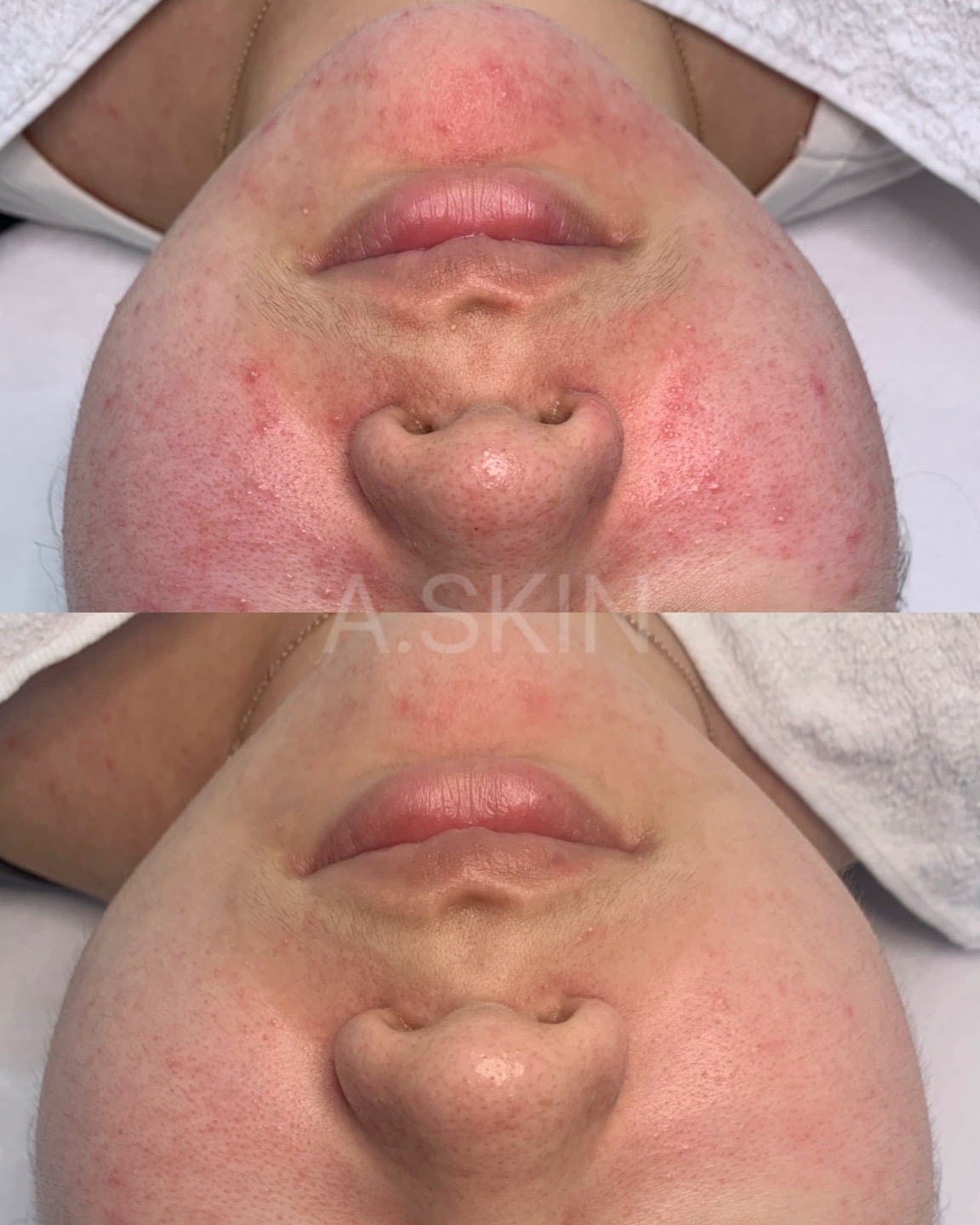 에이스킨 여의도점 대표 이미지