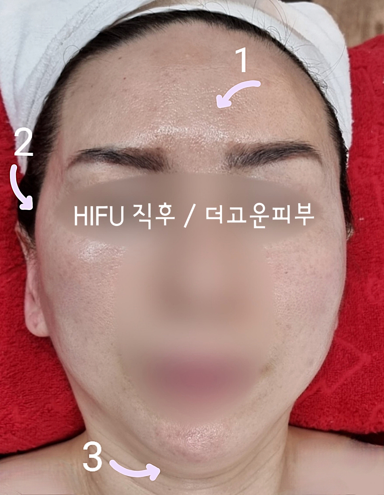 더고운피부에스테틱