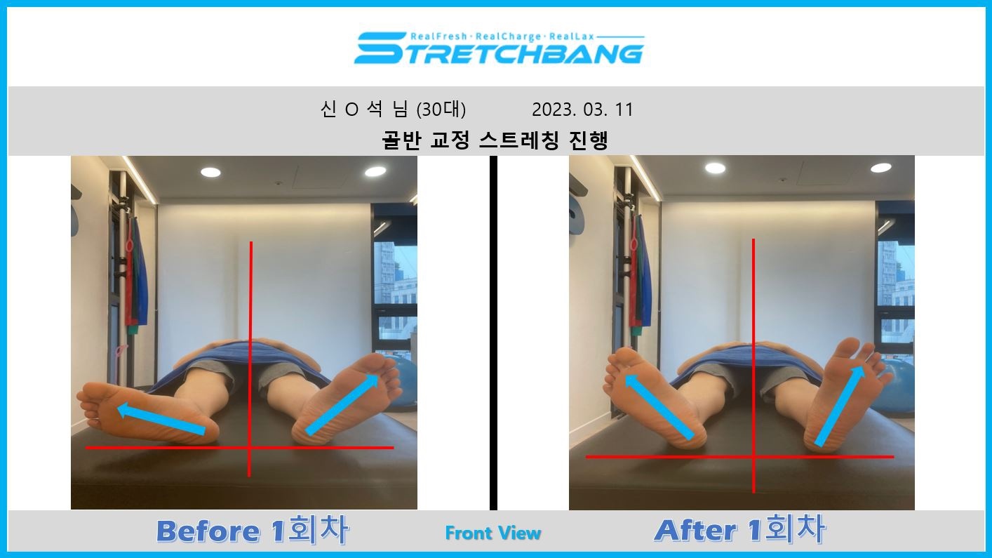 스트레치뱅 송파점