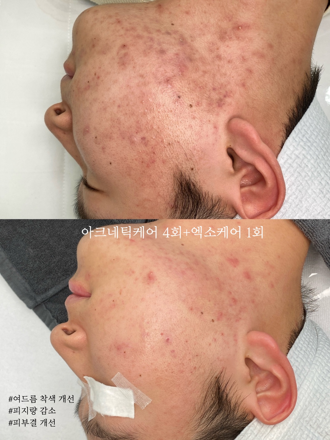 아크네틱하우스 이미지