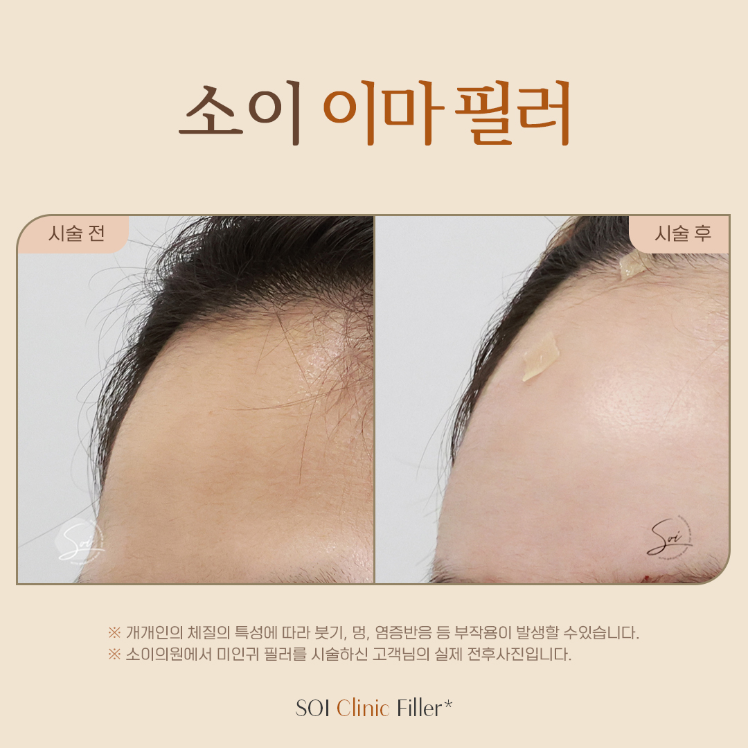 소이의원 대표 이미지