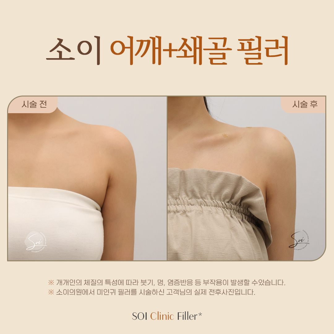 소이의원 대표 이미지