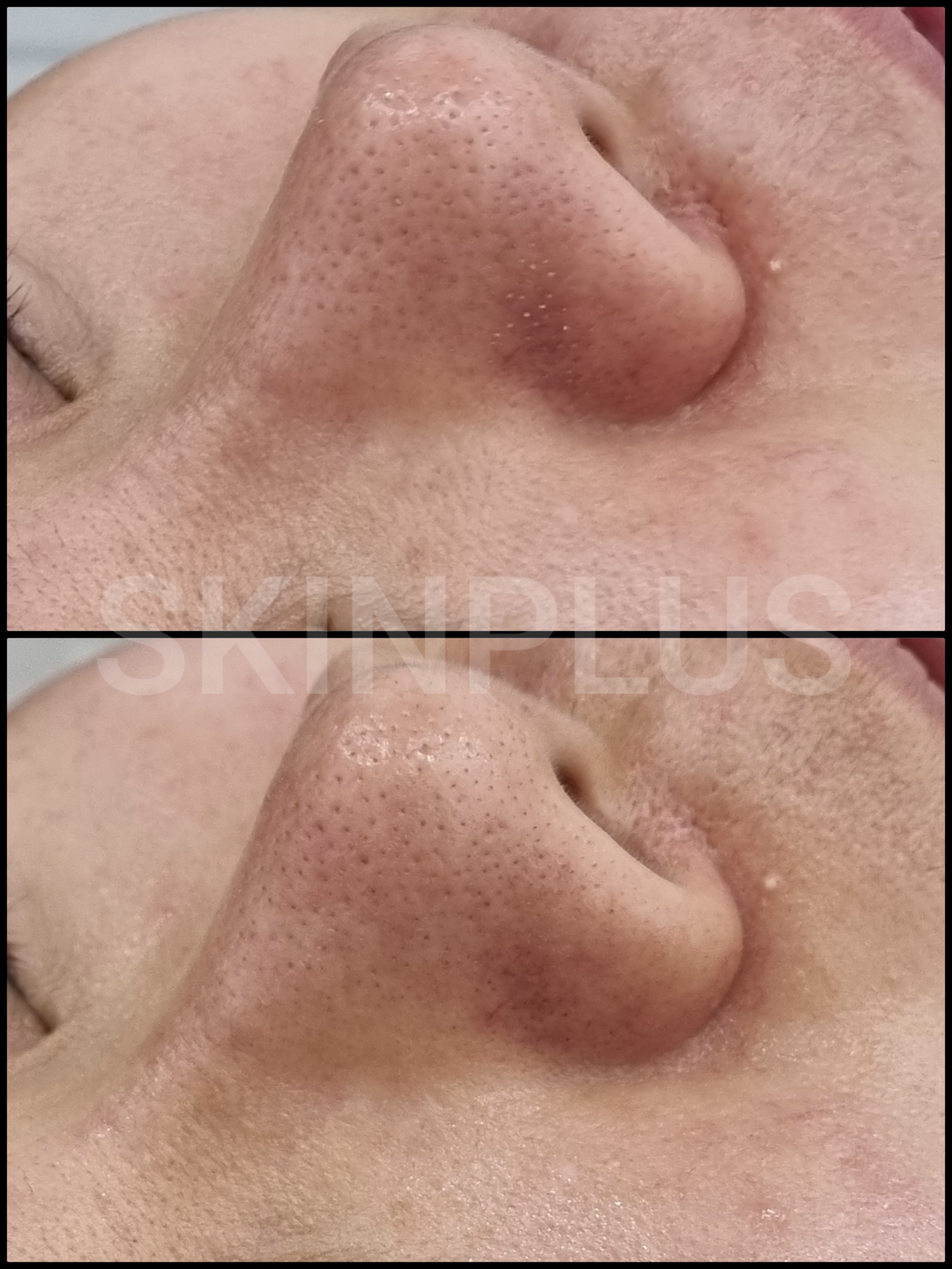 스킨플러스 대표 이미지