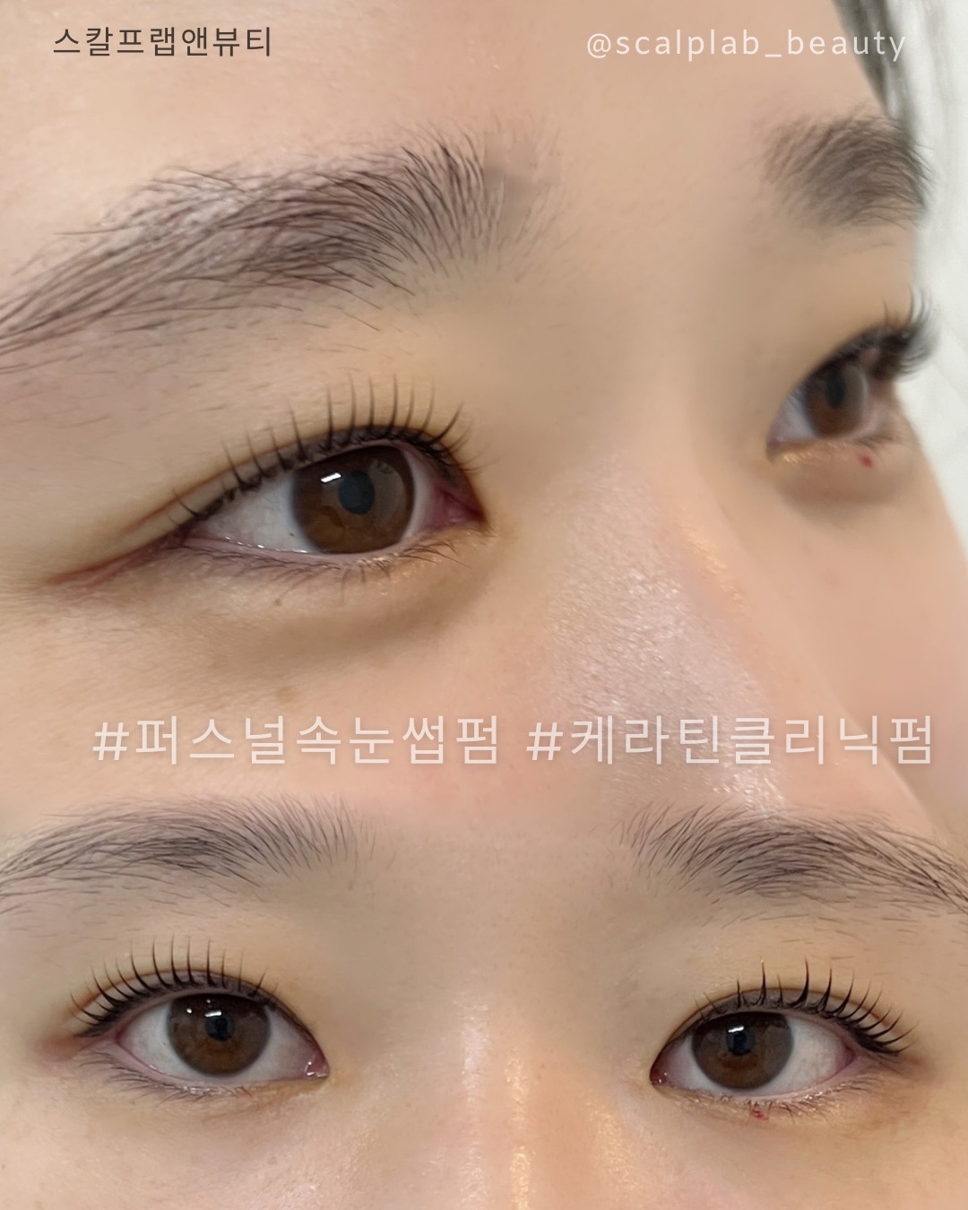 스칼프랩앤뷰티 속눈썹&눈썹&탈모 의정부점