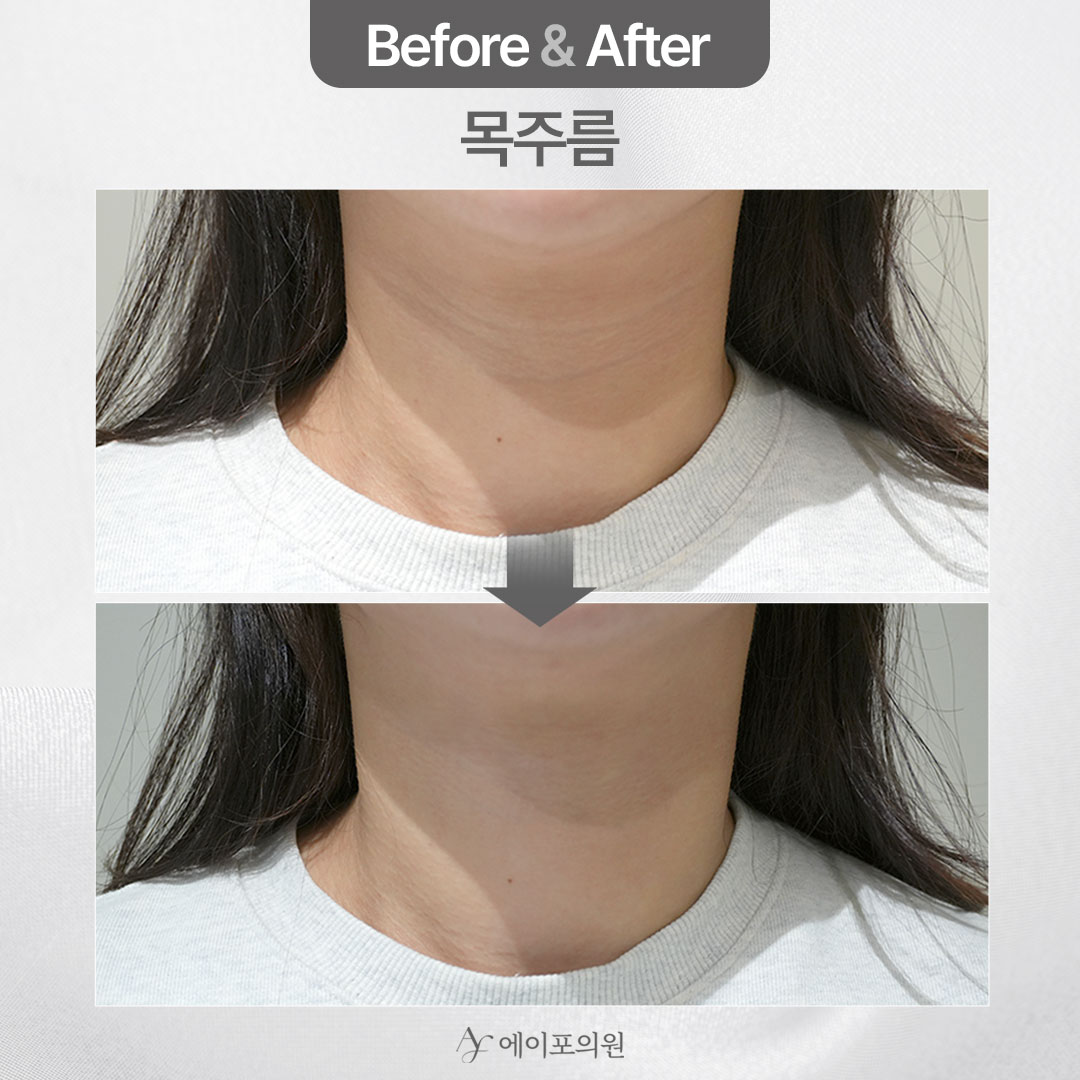 에이포의원 압구정 대표 이미지