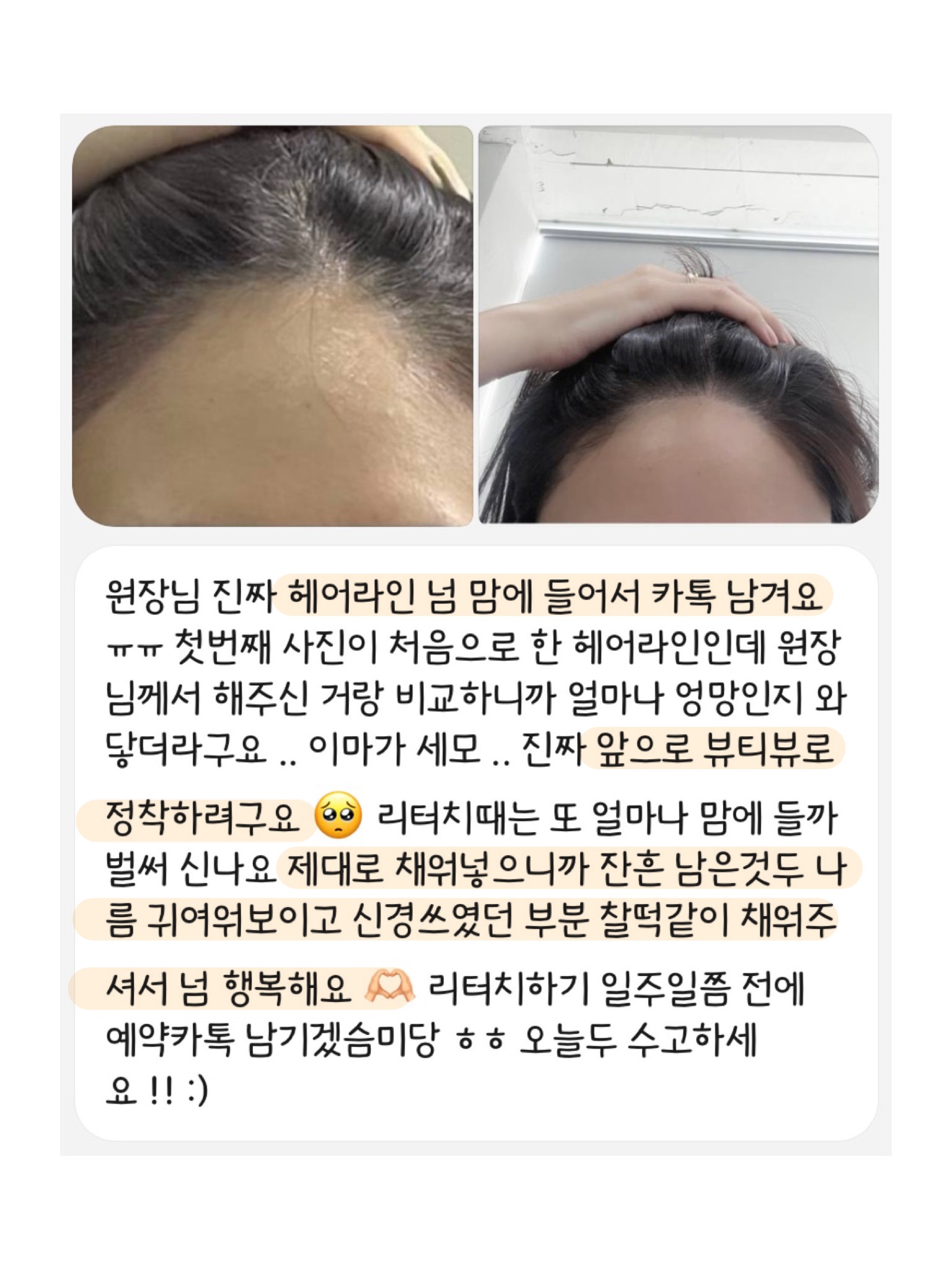 뷰티뷰 헤어라인