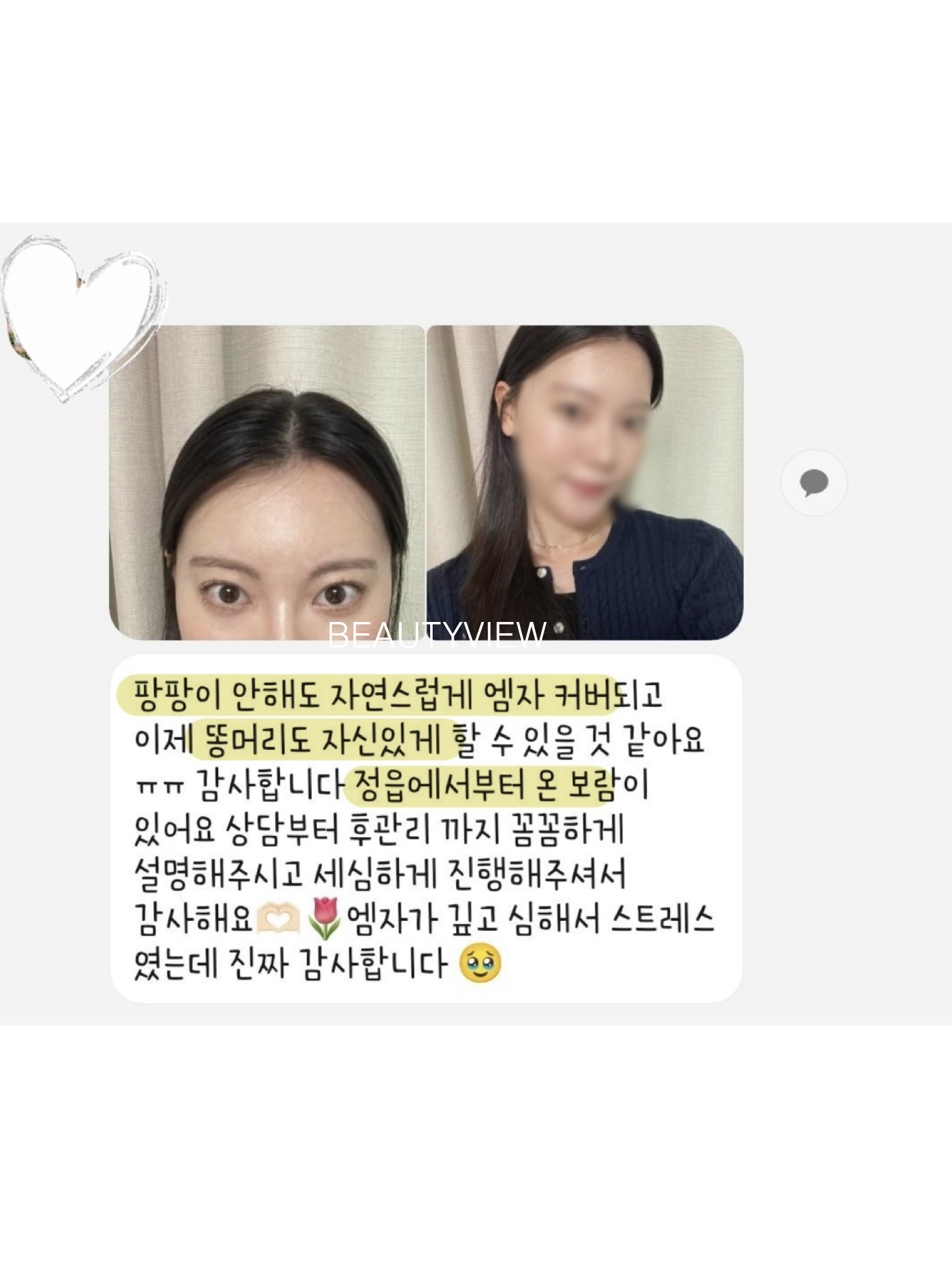 뷰티뷰 헤어라인