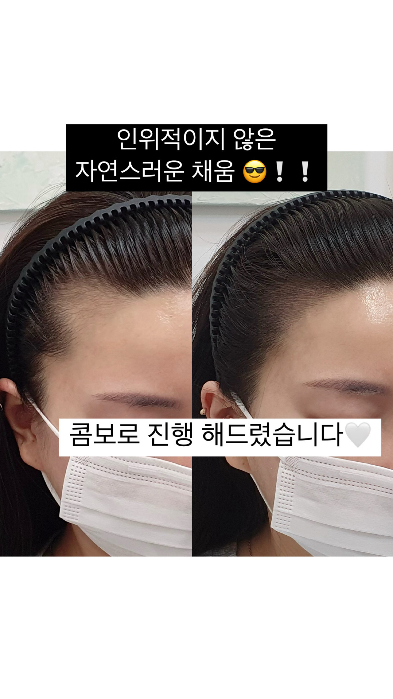 뷰티뷰 헤어라인
