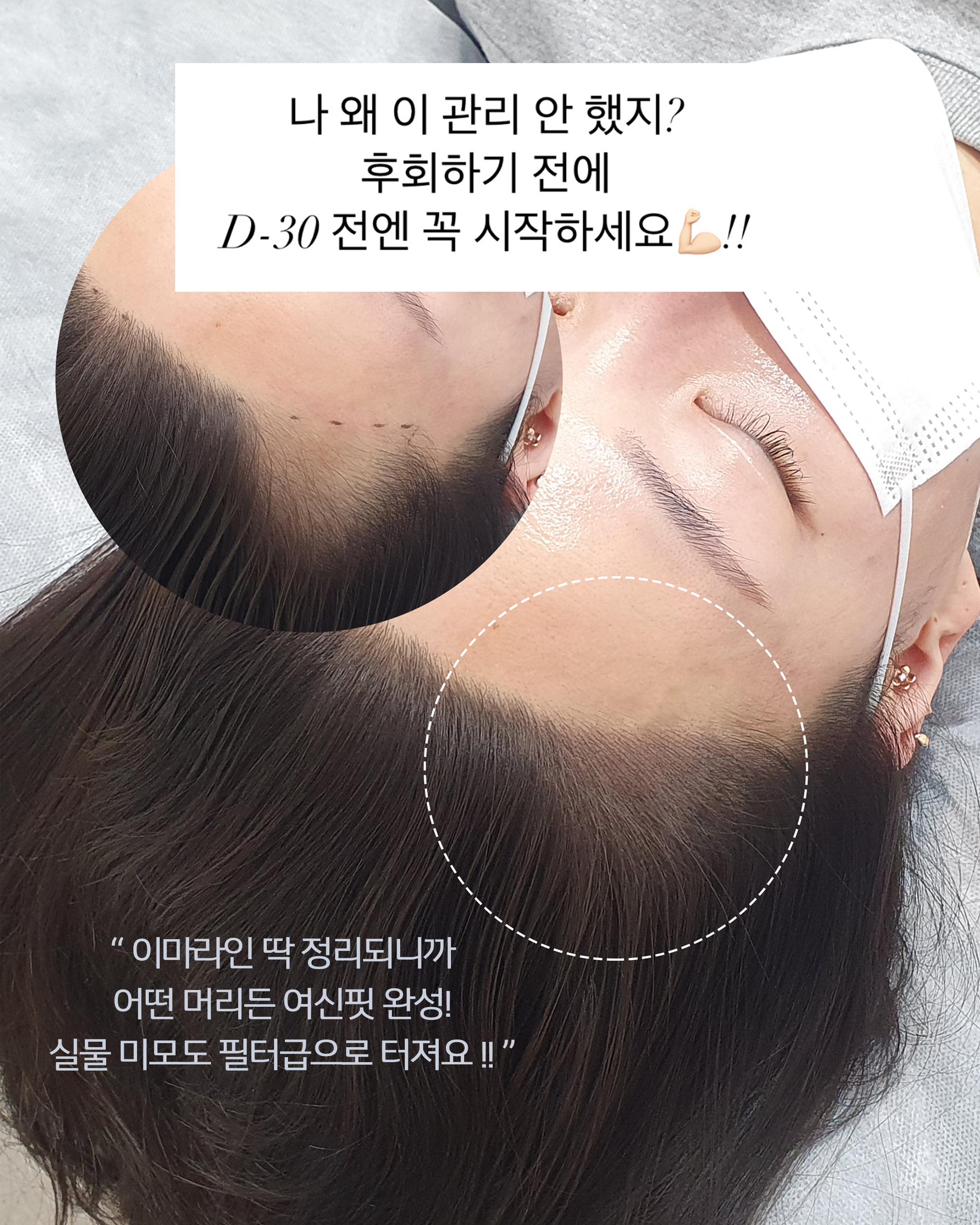 뷰티뷰 헤어라인