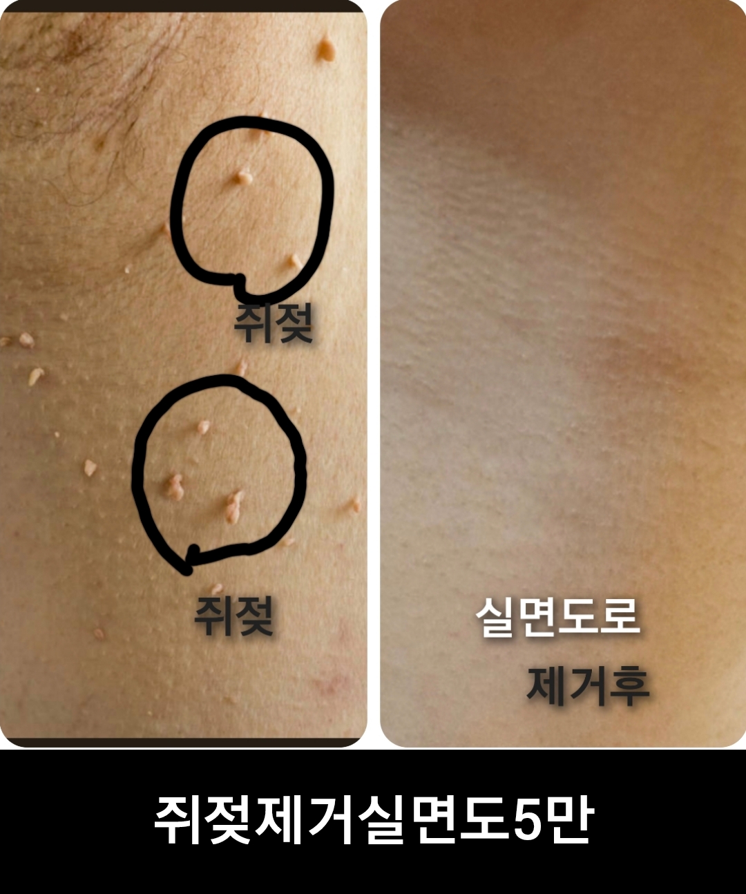 채은아트,속눈섭
