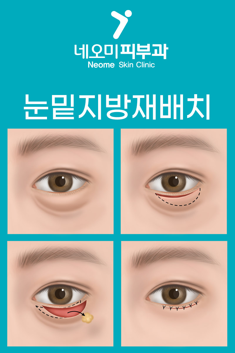 네오미피부과의원