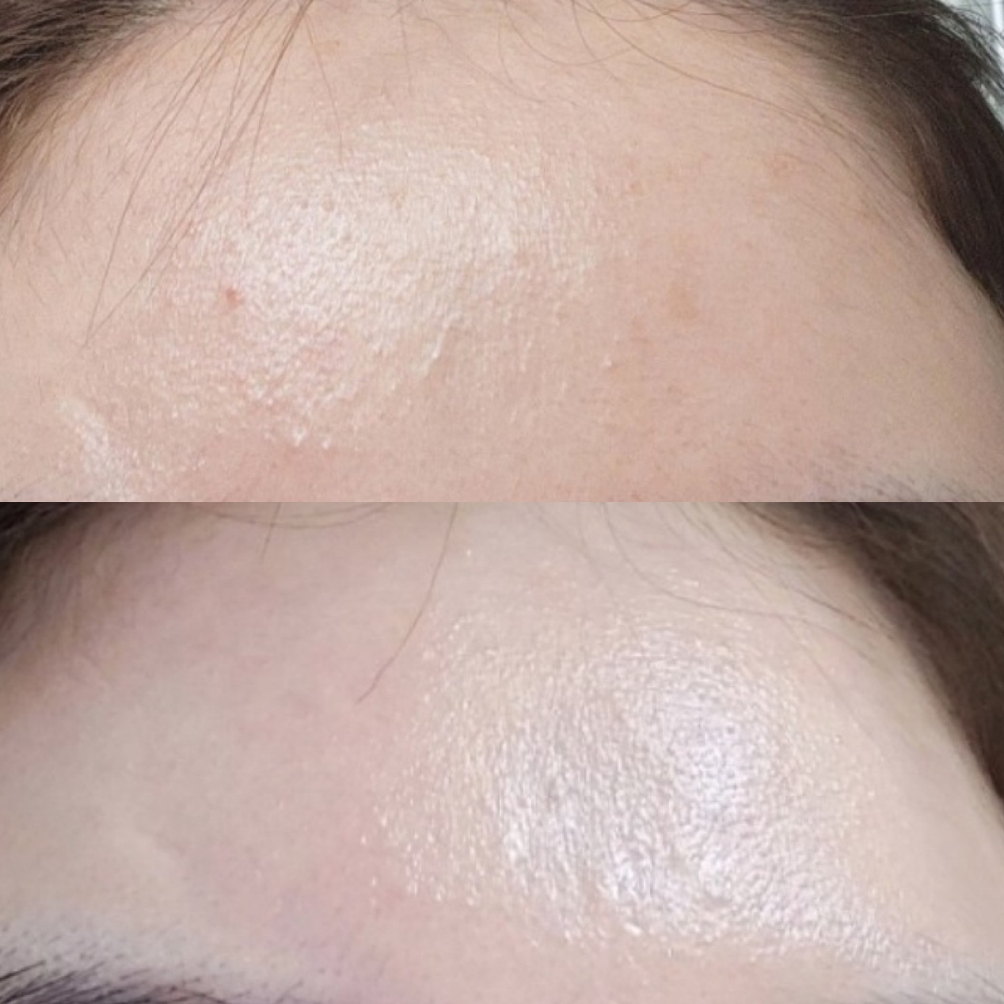 샤인온에스테틱 대표 이미지