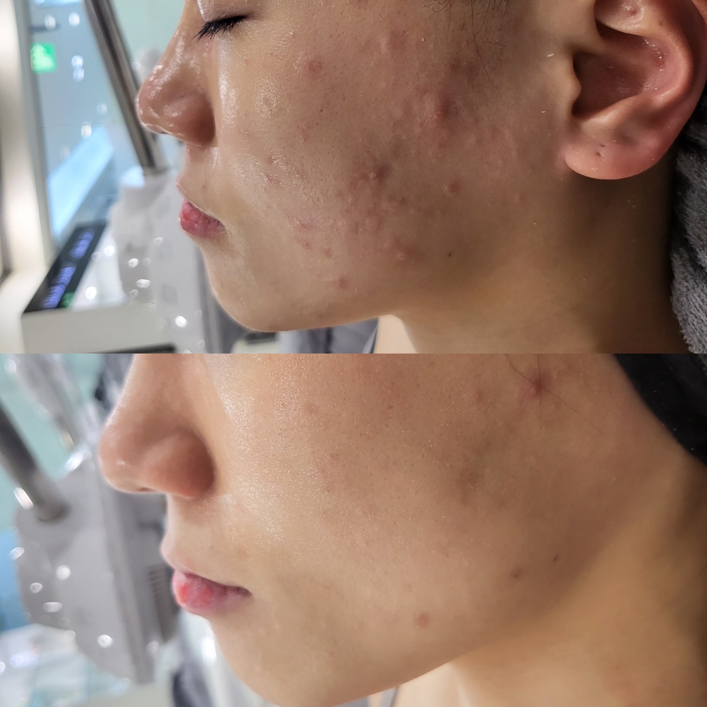샤인온에스테틱 파주운정점 대표 이미지
